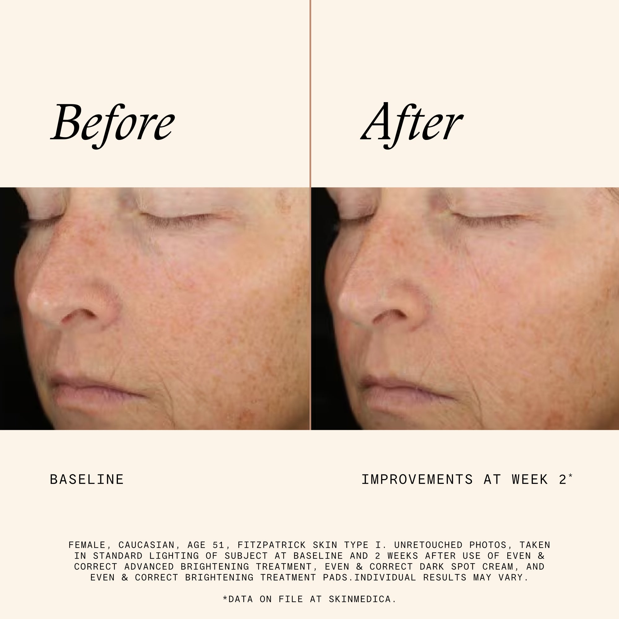 SkinMedica Even & Correct Brightening Treatment Pads (60 count).