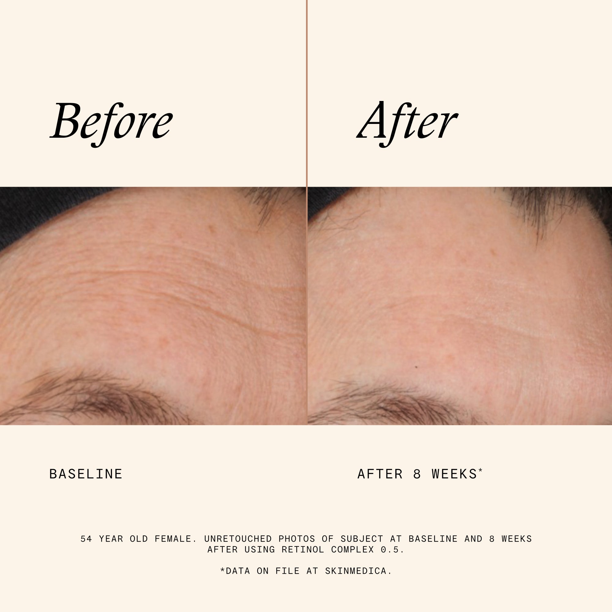SkinMedica Retinol Complex 0.5 (1 oz).