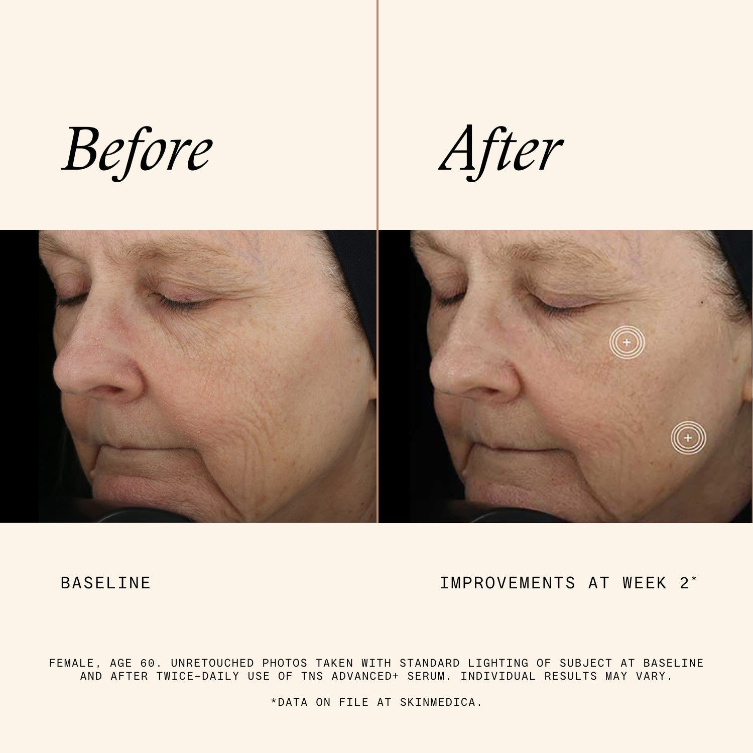 SkinMedica TNS Advanced+ Serum (1 oz)