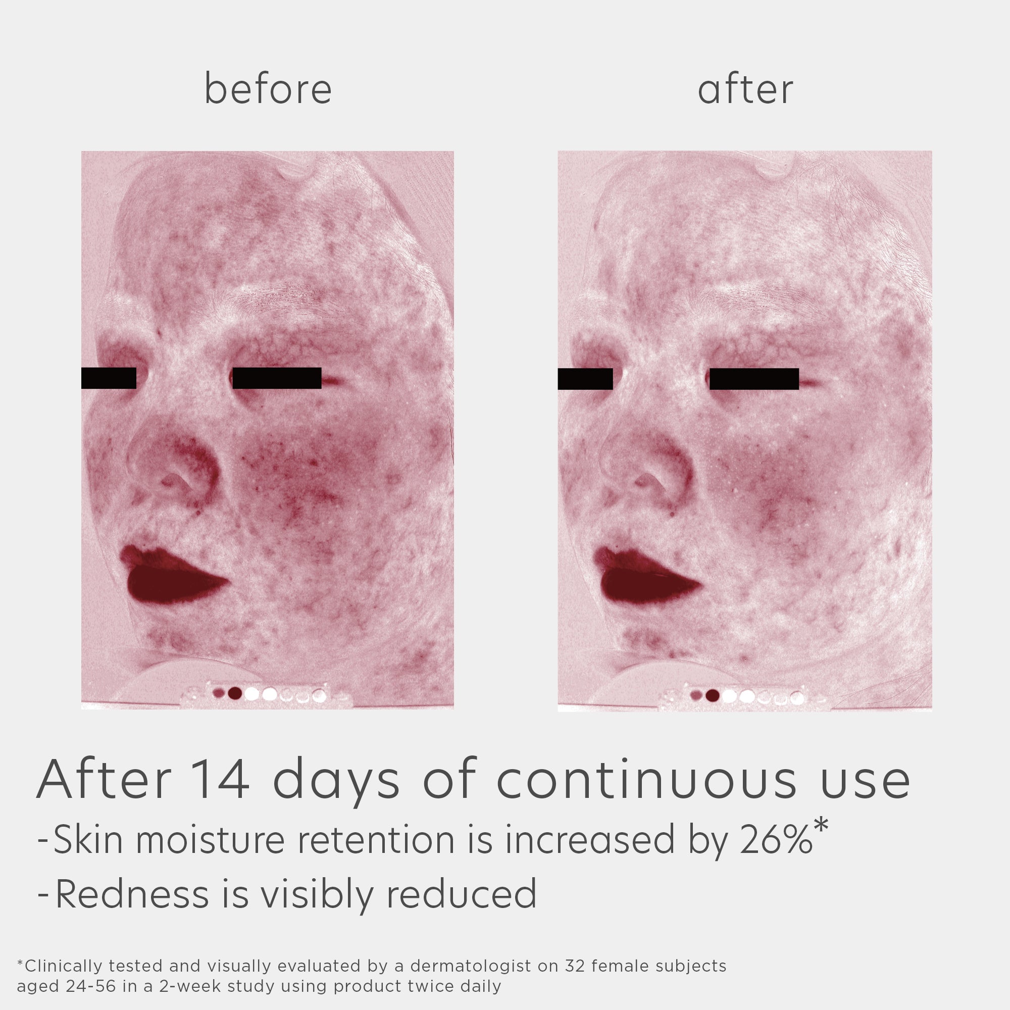 EltaMD Skin Recovery Amino Acid Foaming Cleanser (5 oz).