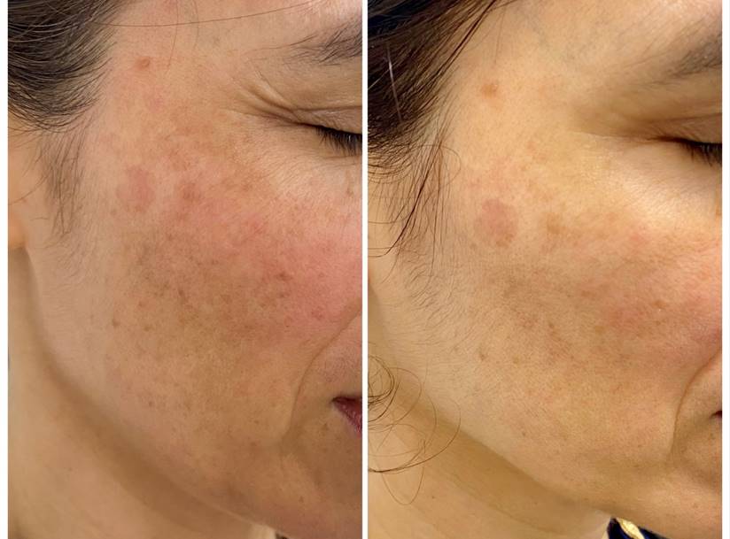 ISDIN Isdinceutics Melaclear Advanced Serum (1.7 oz)