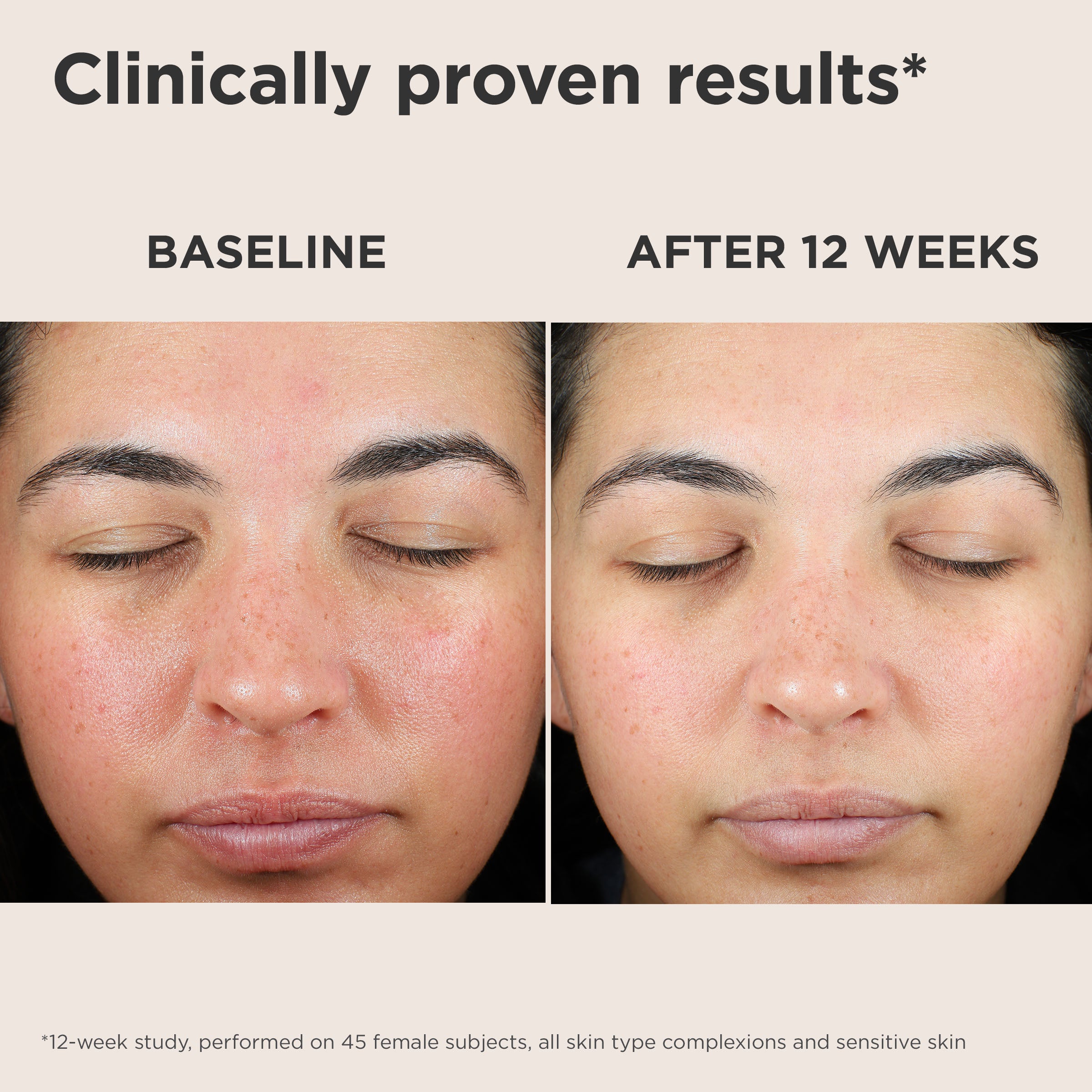 EltaMD UV Skin Recovery Broad Spectrum SPF 50 (1.7 oz)