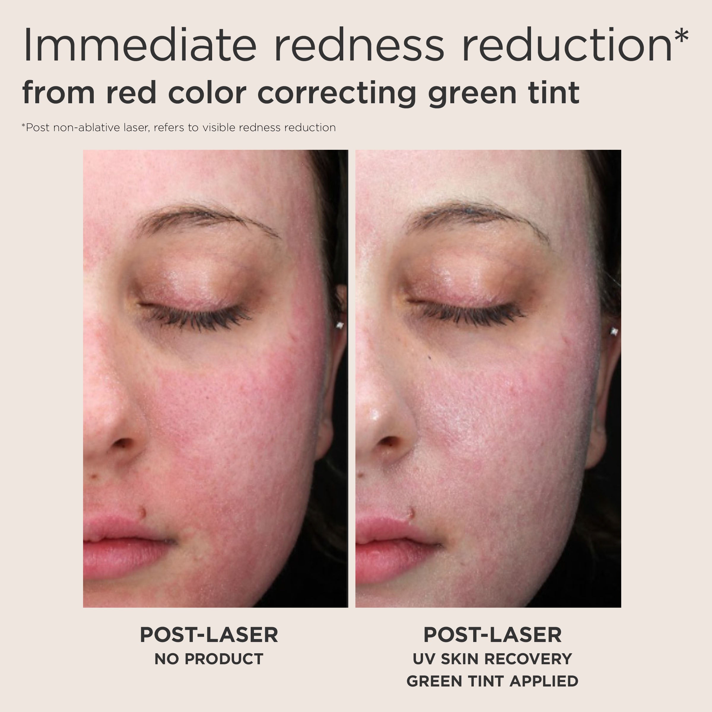 EltaMD UV Skin Recovery Red Color Correcting Green Tint Broad Spectrum SPF 50 (1.7 oz).
