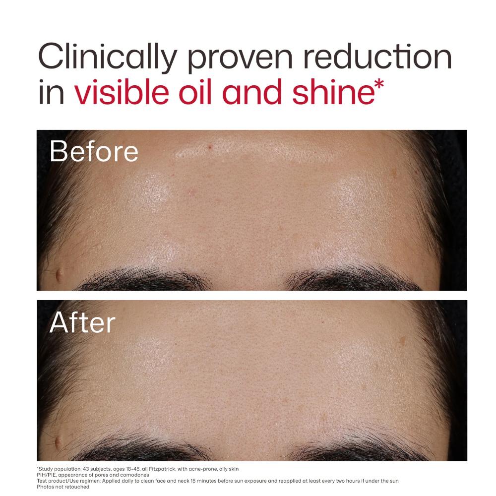 EltaMD UV Clear Blemish-Prone & Oil Balancing SPF 50 (1.7 oz)
