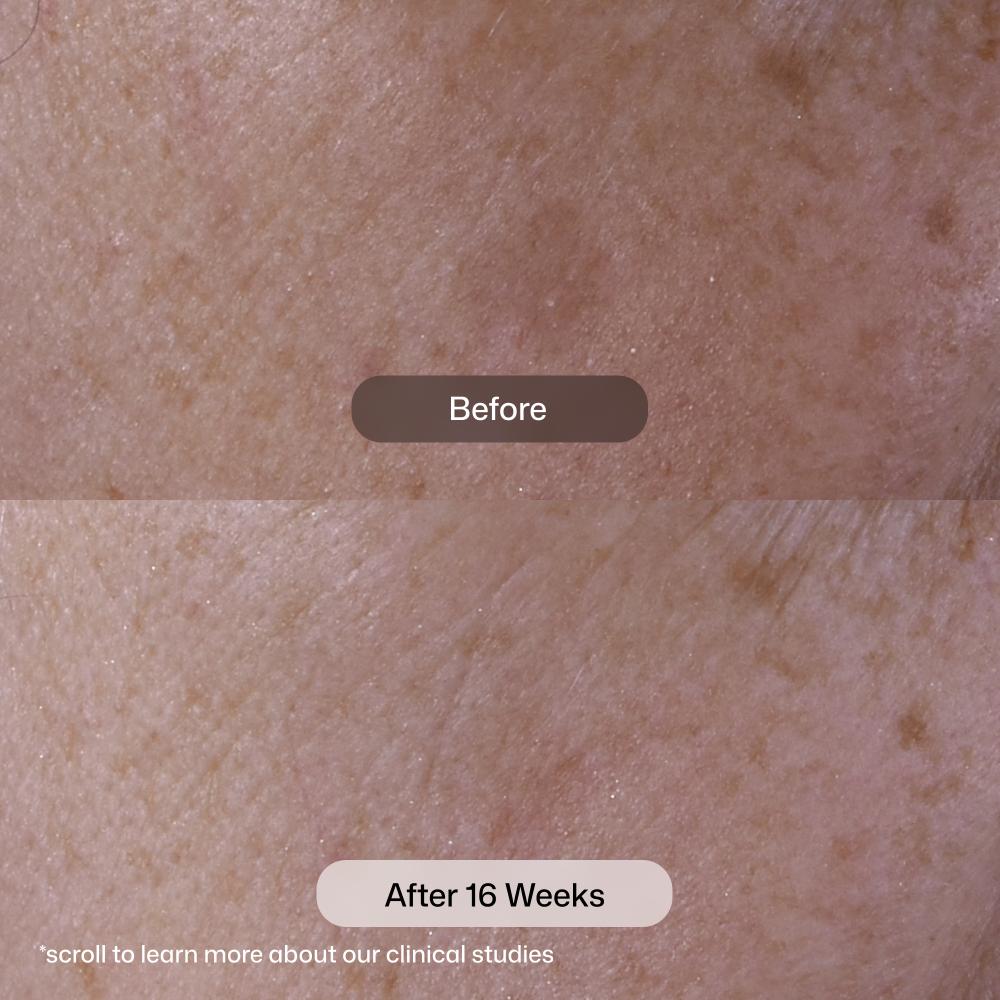 Revision Skincare Advanced Pigment Corrector+ (1 oz)