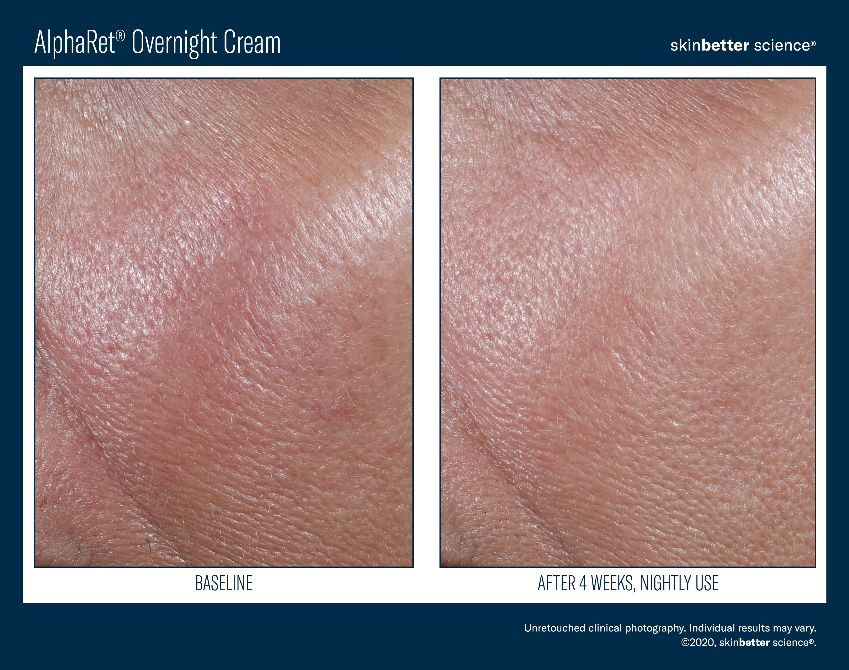 SkinBetter Science Travel Size AlphaRet Overnight Cream (0.5 oz).