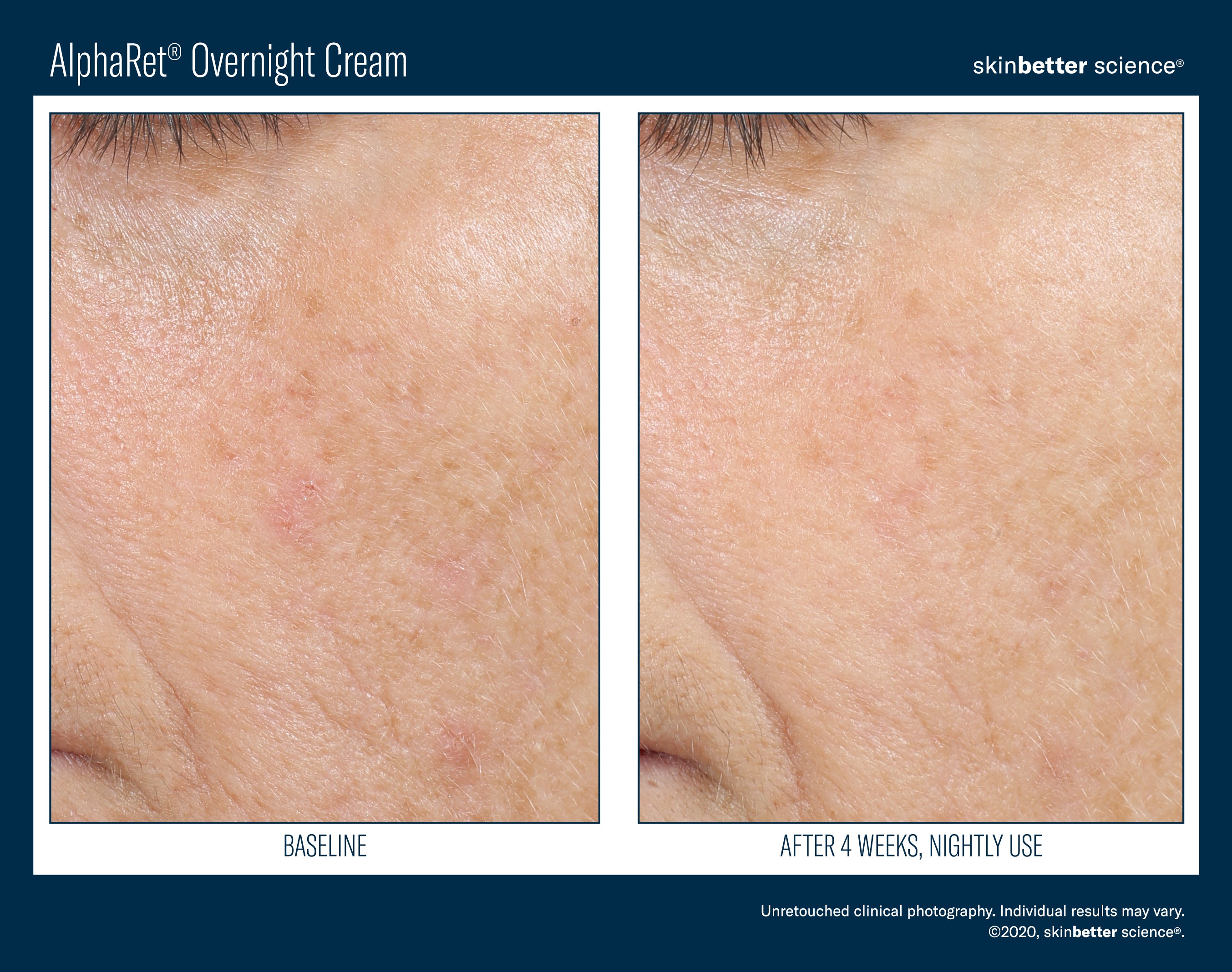 SkinBetter Science Travel Size AlphaRet Overnight Cream (0.5 oz).