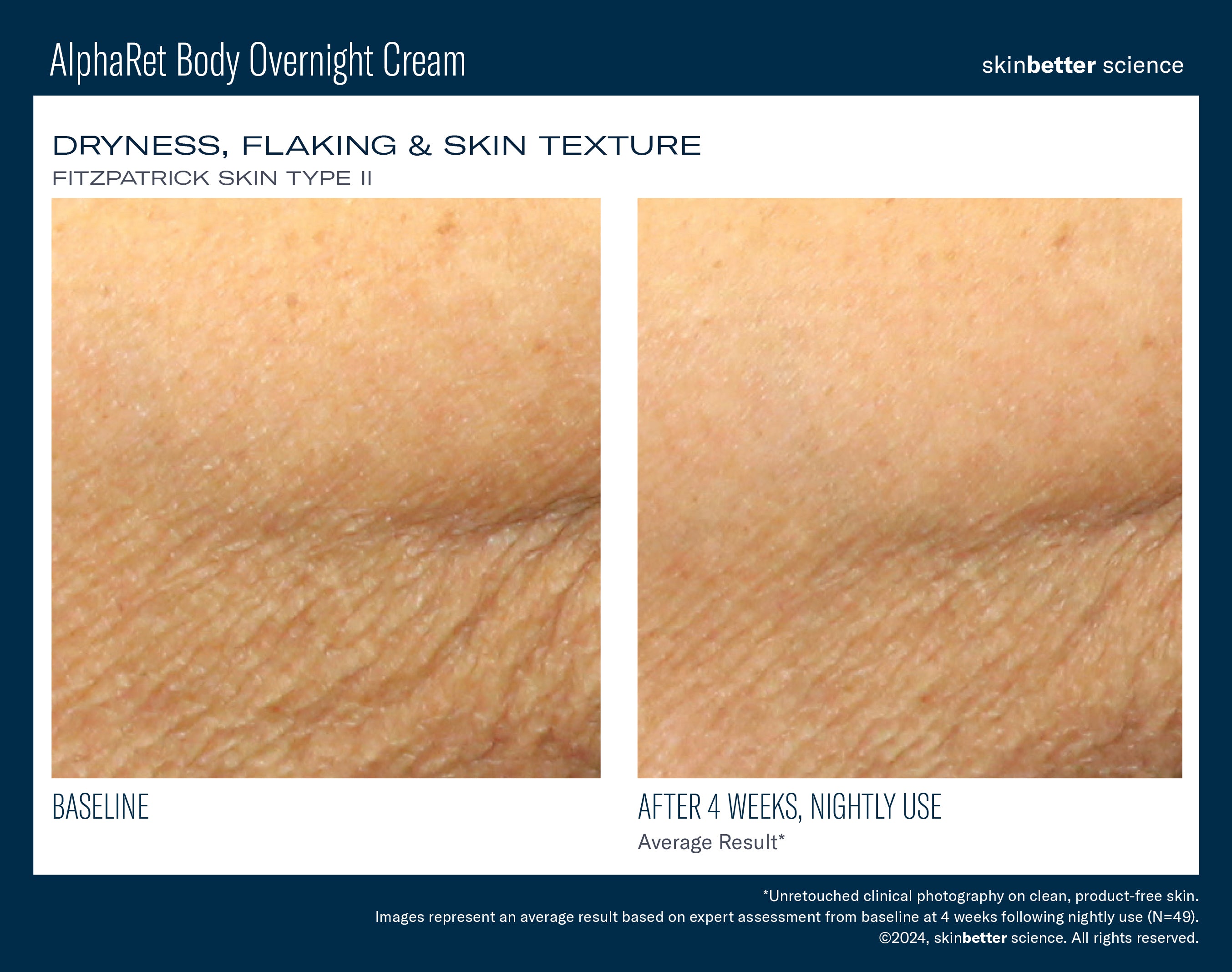 SkinBetter Science AlphaRet Body Overnight Cream (5 oz).