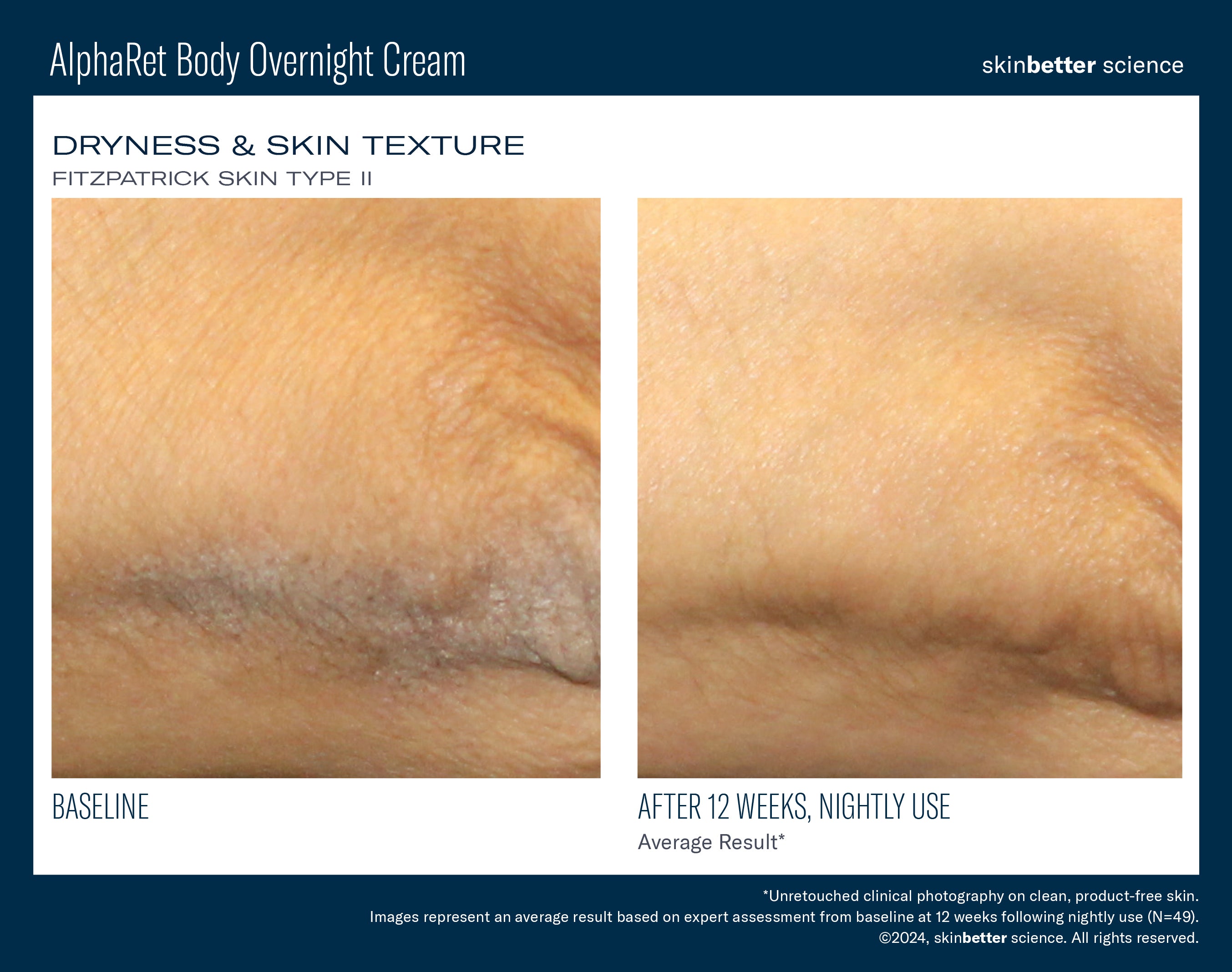 SkinBetter Science Travel Size AlphaRet Body Overnight Cream (0.5 oz).