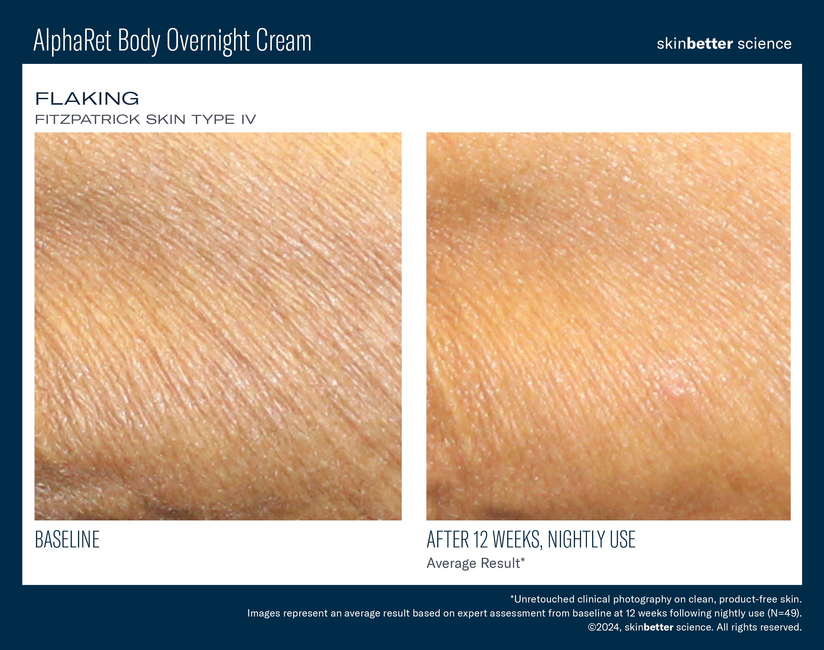 SkinBetter Science Travel Size AlphaRet Body Overnight Cream (0.5 oz).
