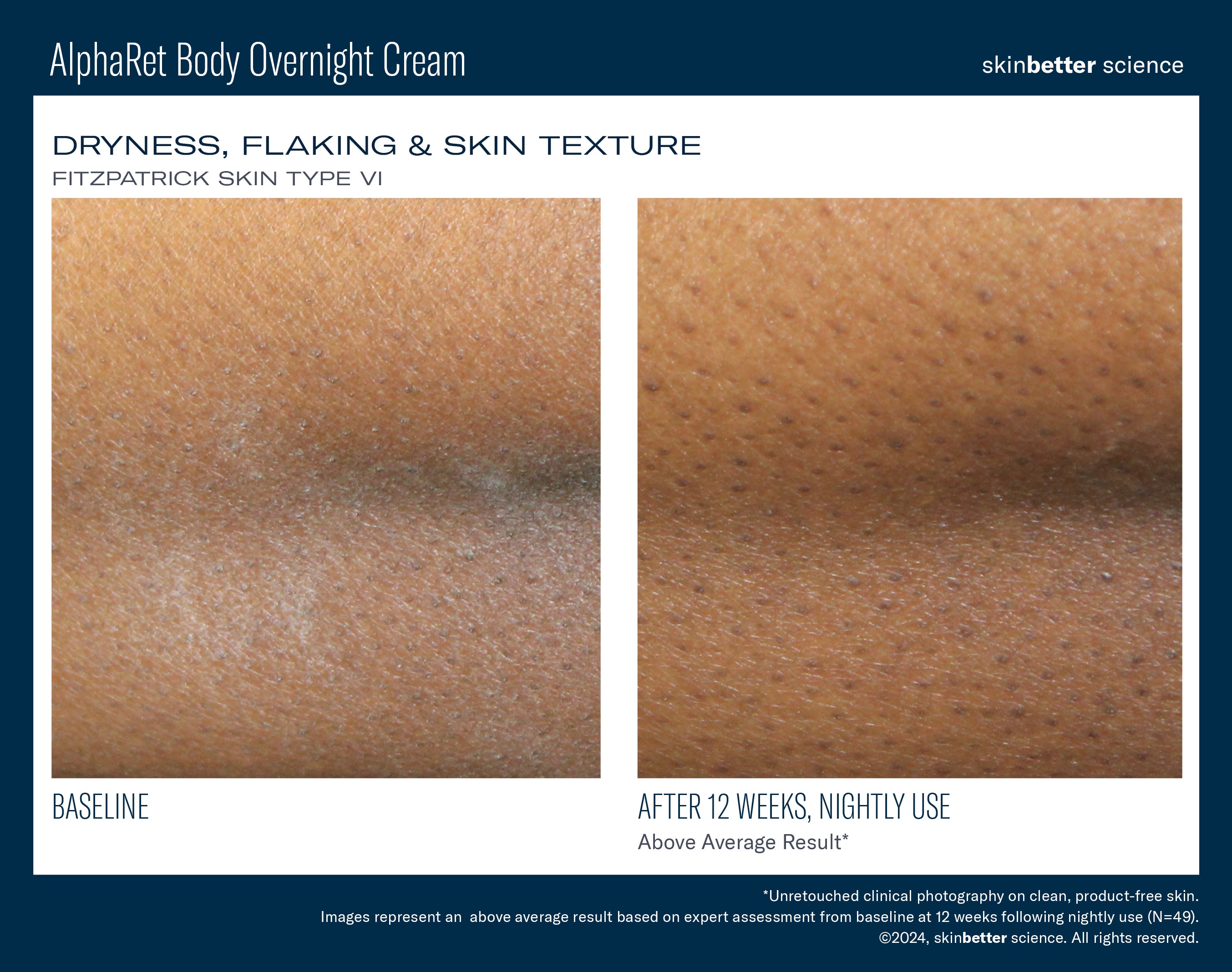 SkinBetter Science AlphaRet Body Overnight Cream (5 oz).