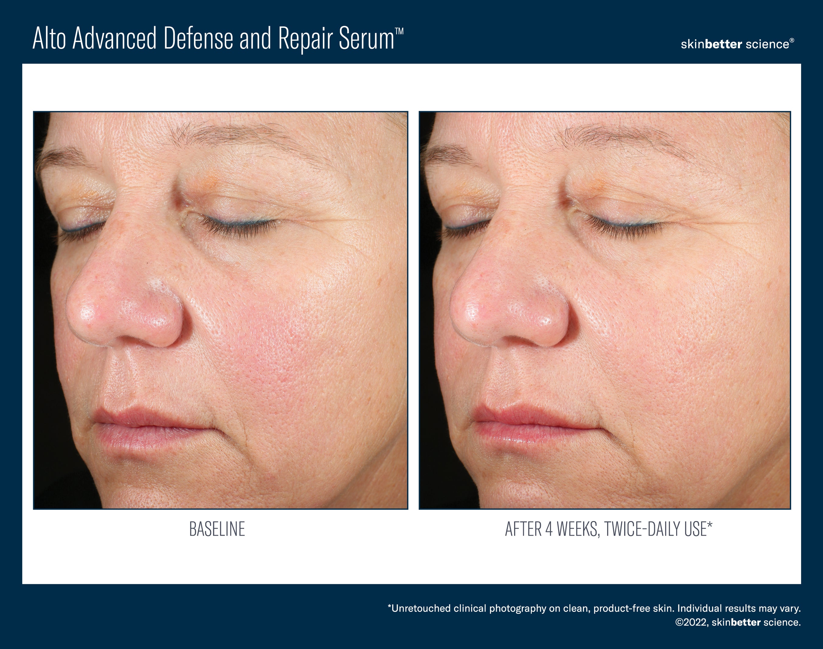 SkinBetter Science Alto Advanced Defense and Repair Serum (1 oz).