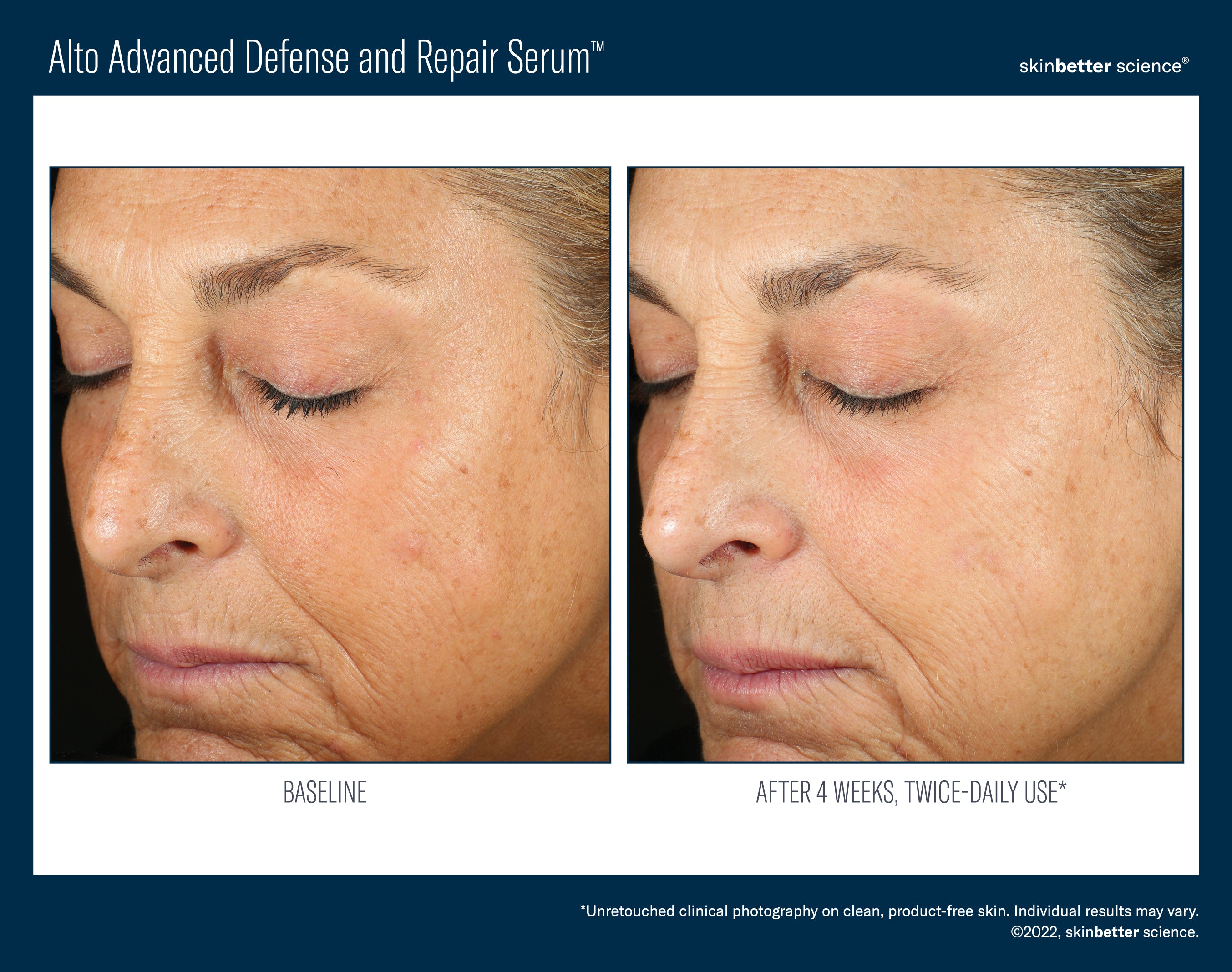 SkinBetter Science Alto Advanced Defense and Repair Serum (1.7 oz).