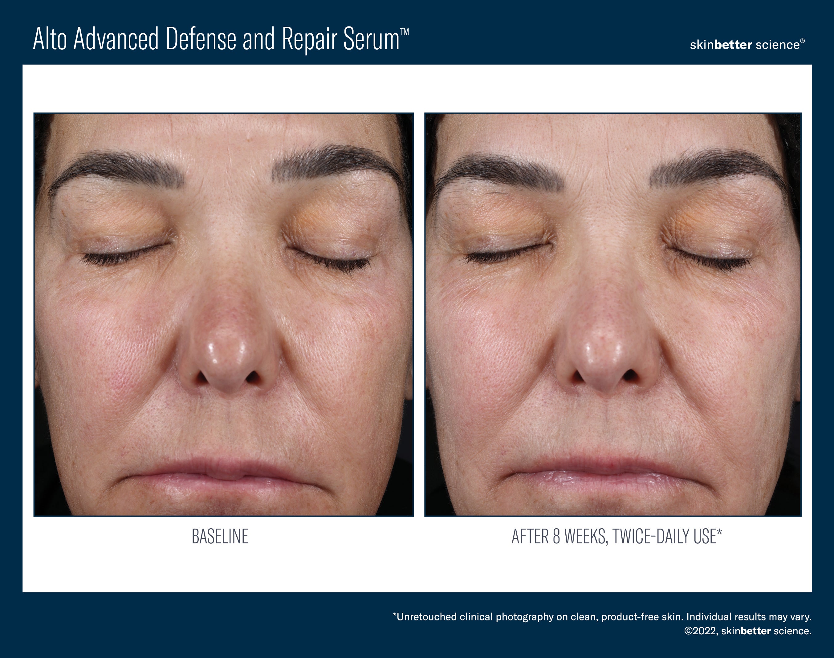 SkinBetter Science Alto Advanced Defense and Repair Serum (1.7 oz).