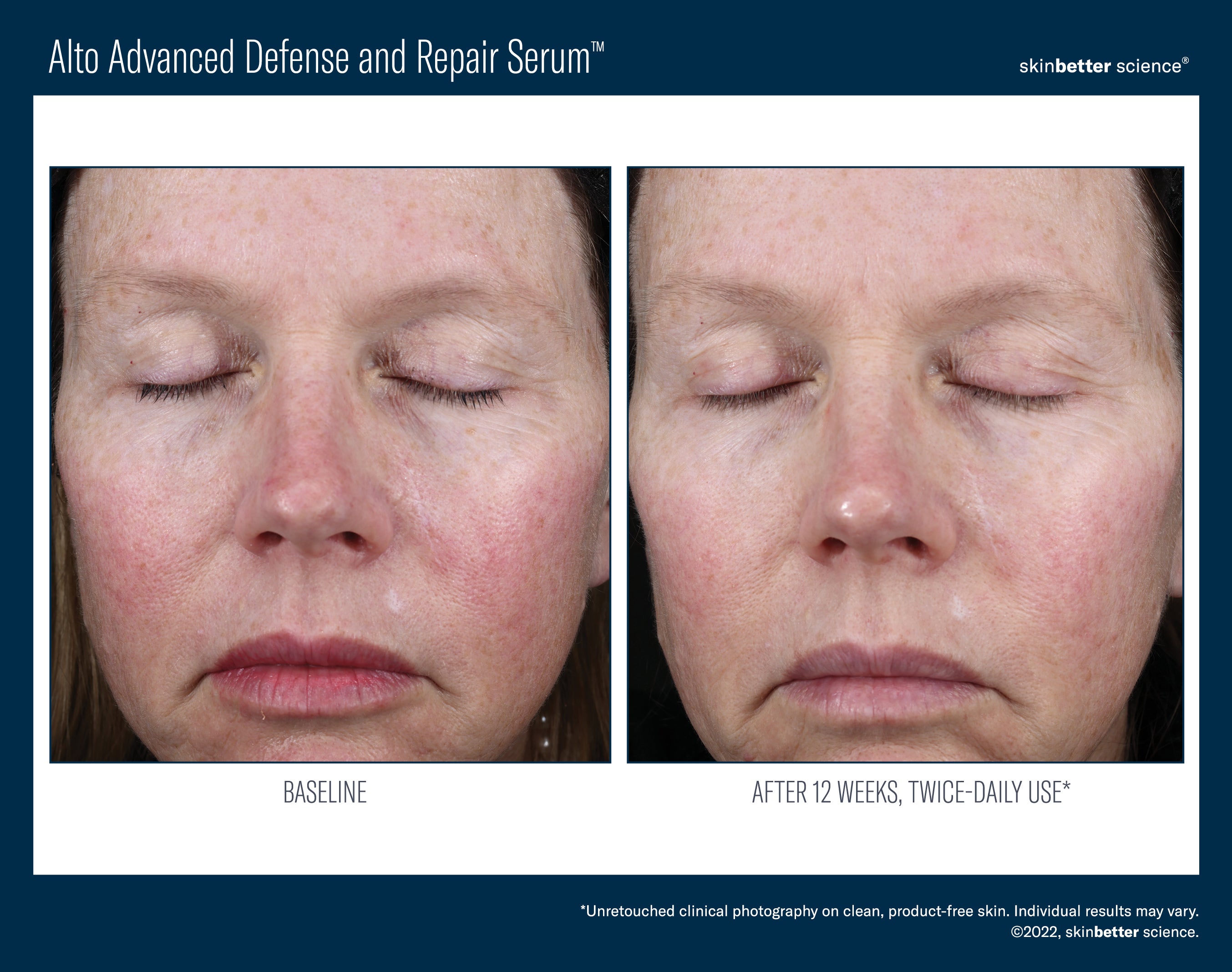 SkinBetter Science Alto Advanced Defense and Repair Serum (1 oz).
