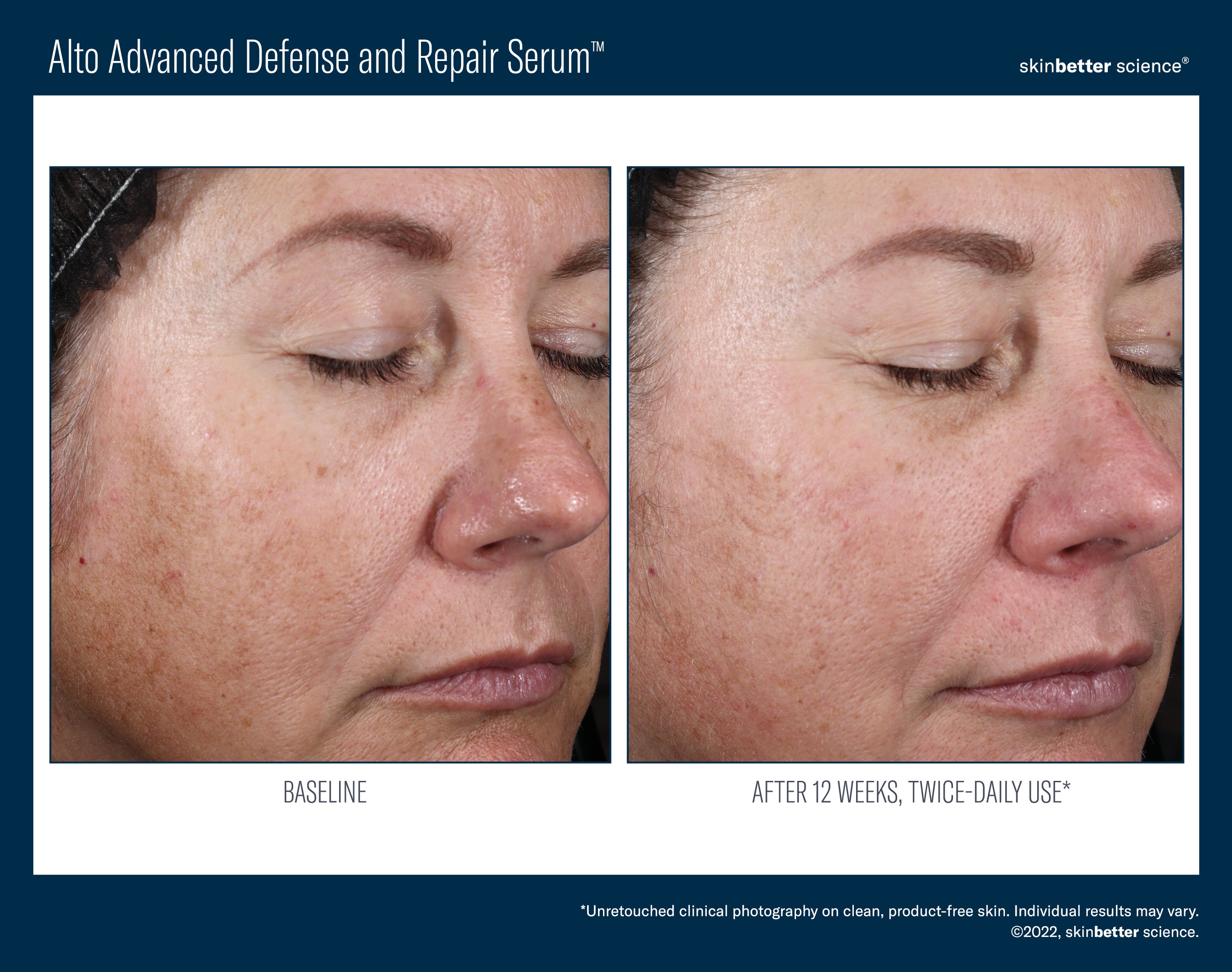 SkinBetter Science Alto Advanced Defense and Repair Serum (1 oz).