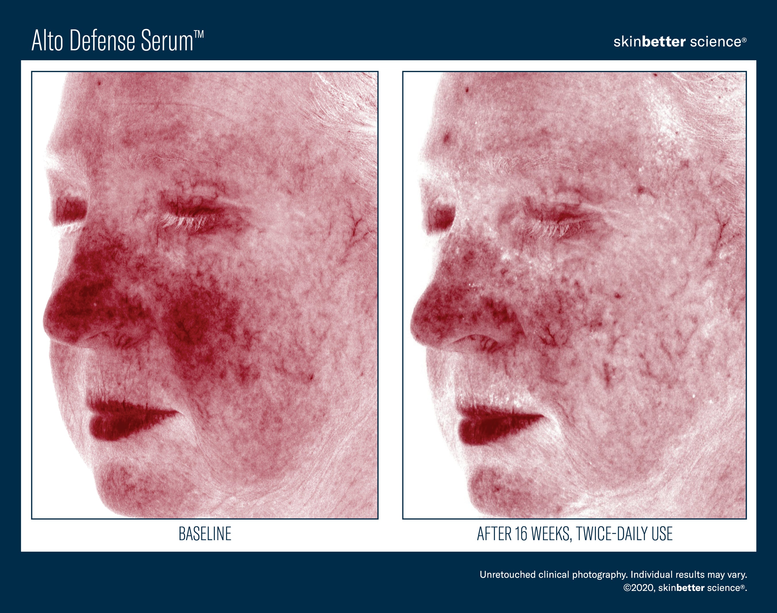 SkinBetter Science Alto Defense Serum (1.69 oz).