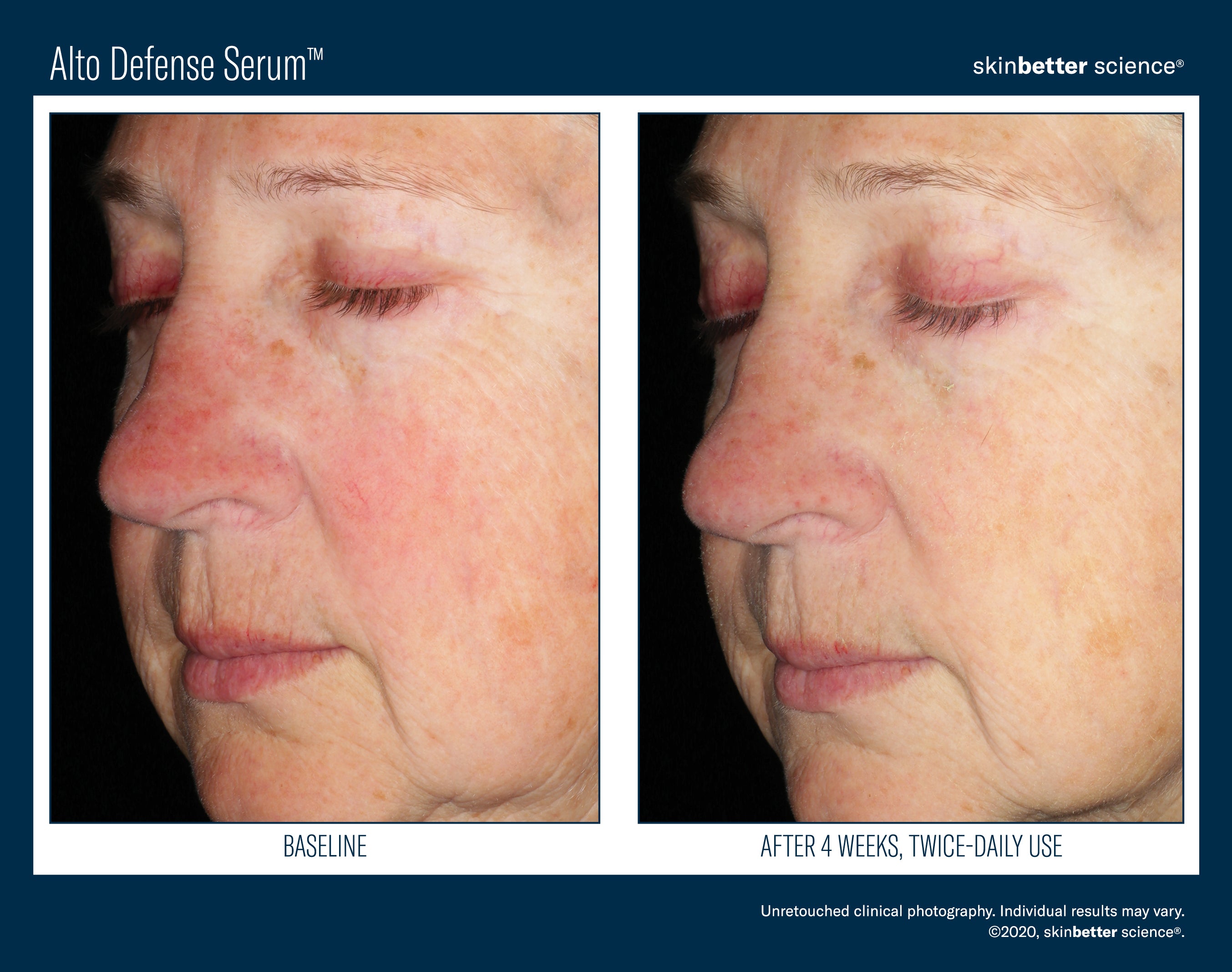 SkinBetter Science Alto Defense Serum (1.69 oz).