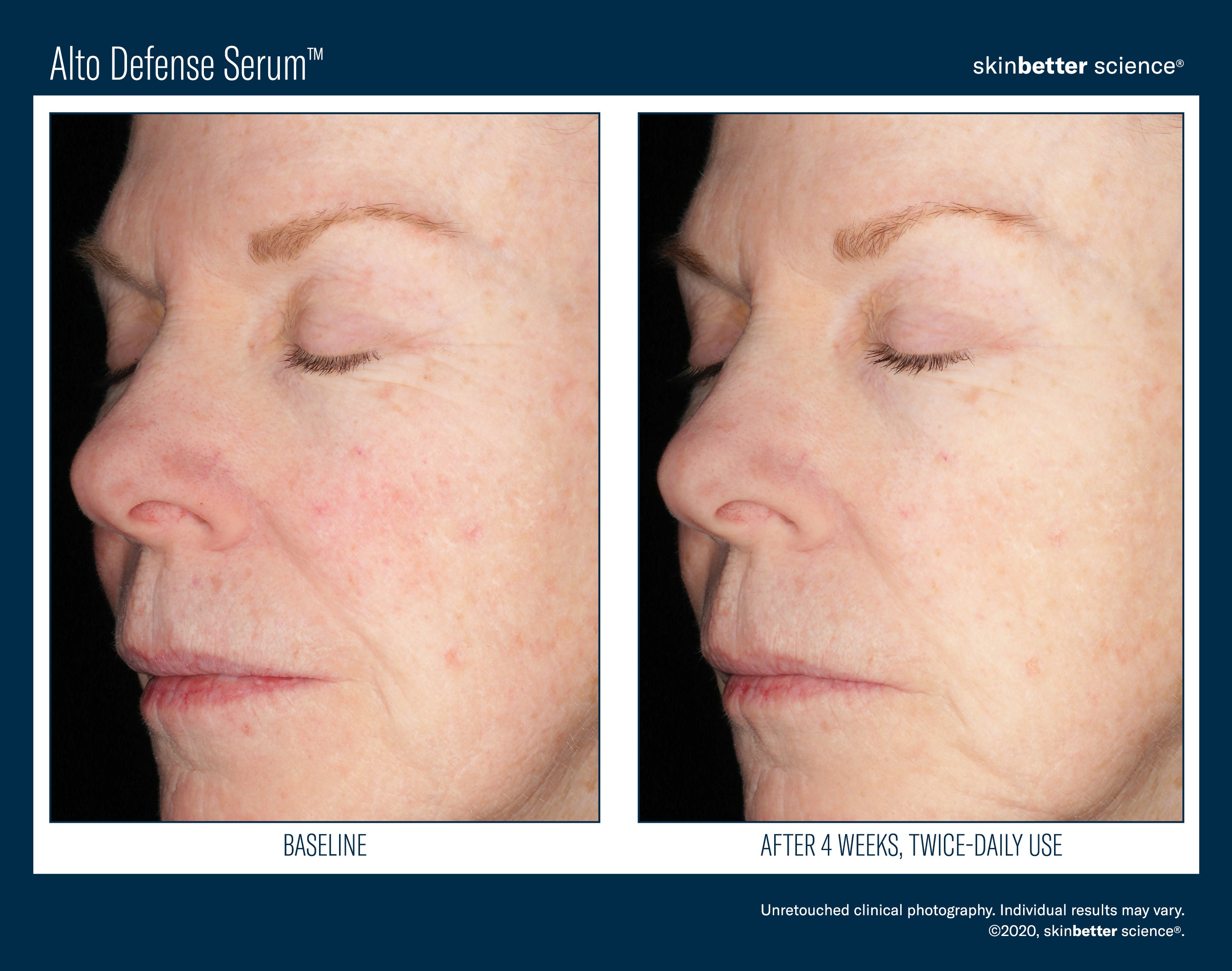 SkinBetter Science Alto Defense Serum (1.69 oz).