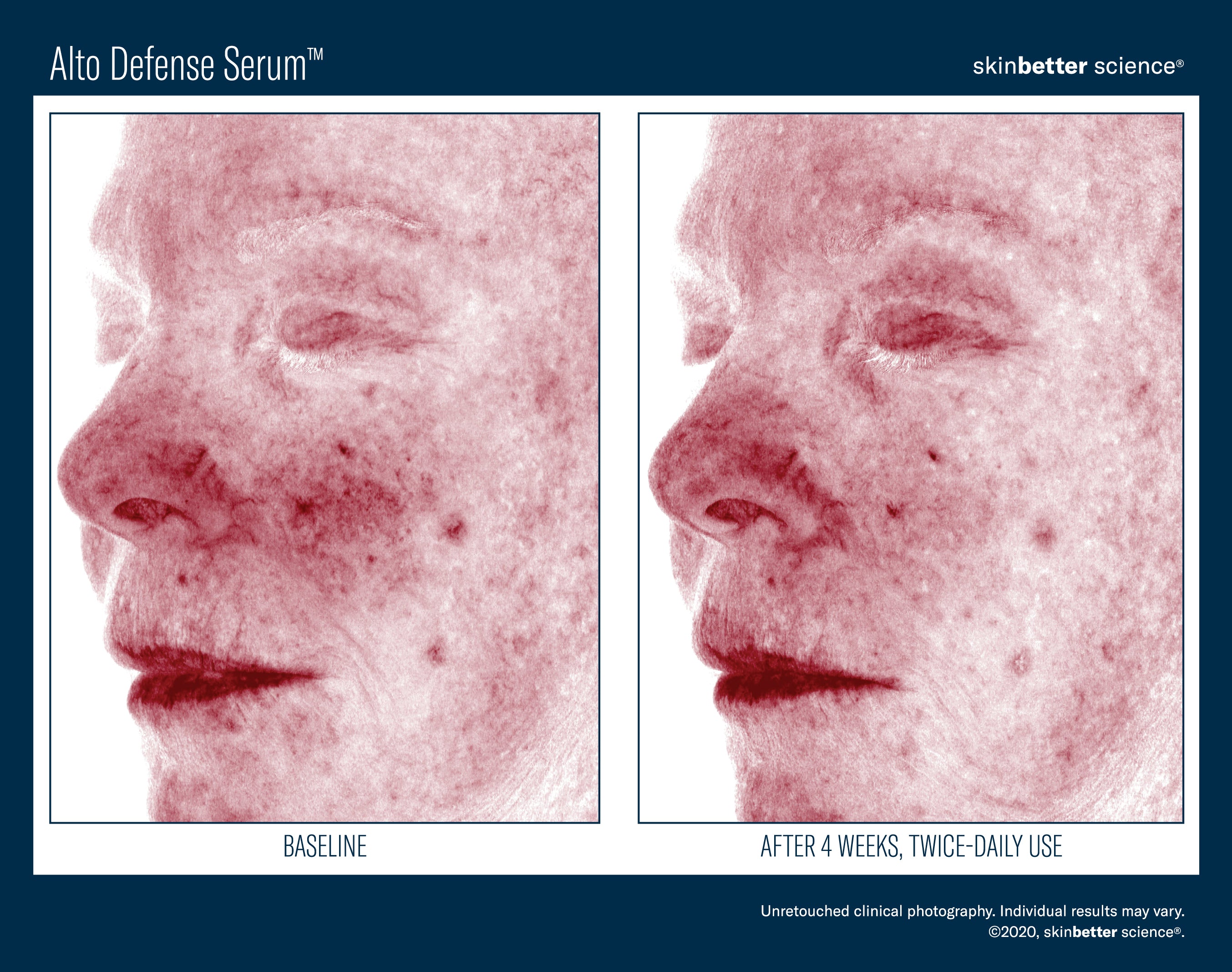 SkinBetter Science Alto Defense Serum (1.69 oz).