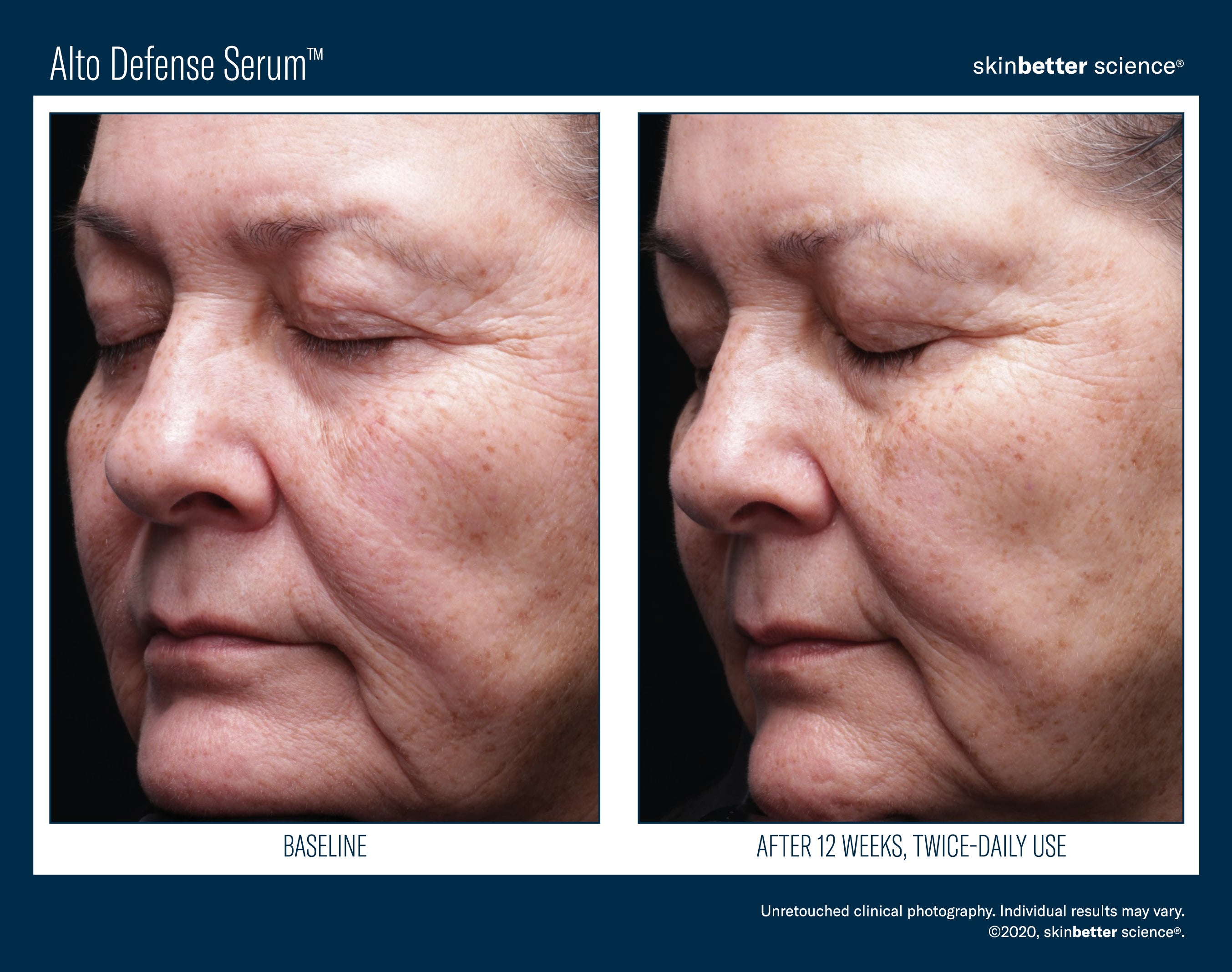 SkinBetter Science Alto Defense Serum (1.69 oz).