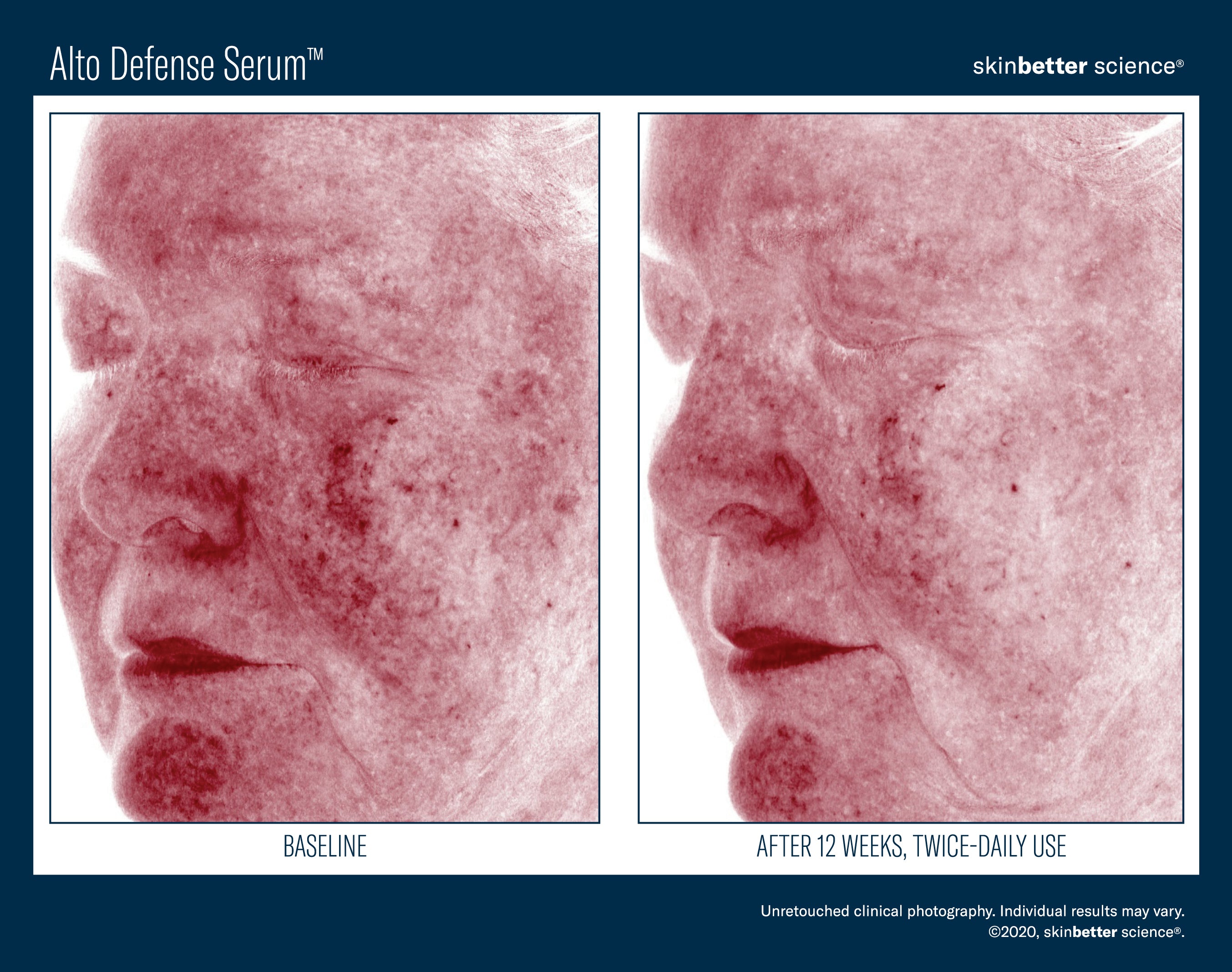SkinBetter Science Alto Defense Serum (1.69 oz).