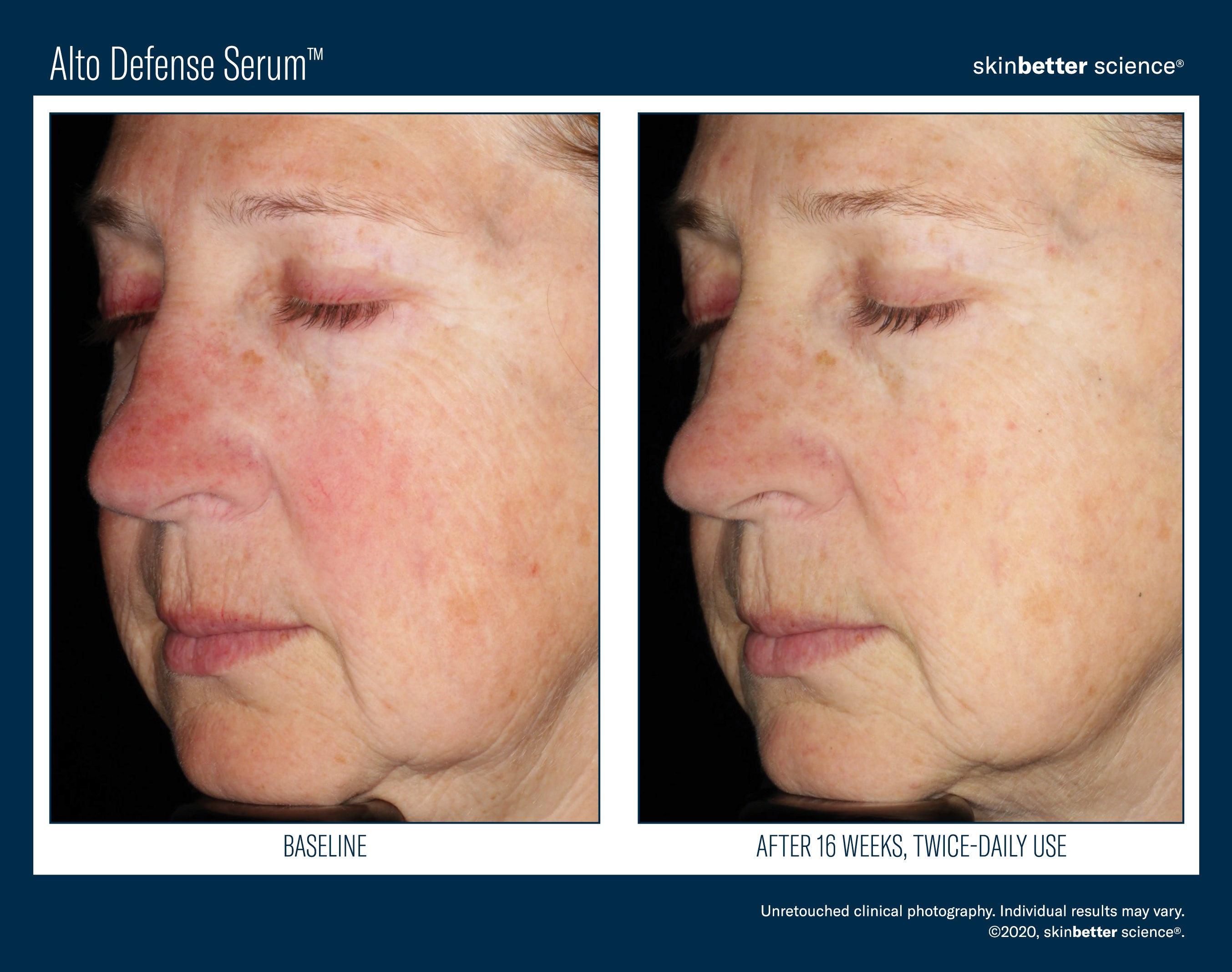 SkinBetter Science Alto Defense Serum (1.69 oz).
