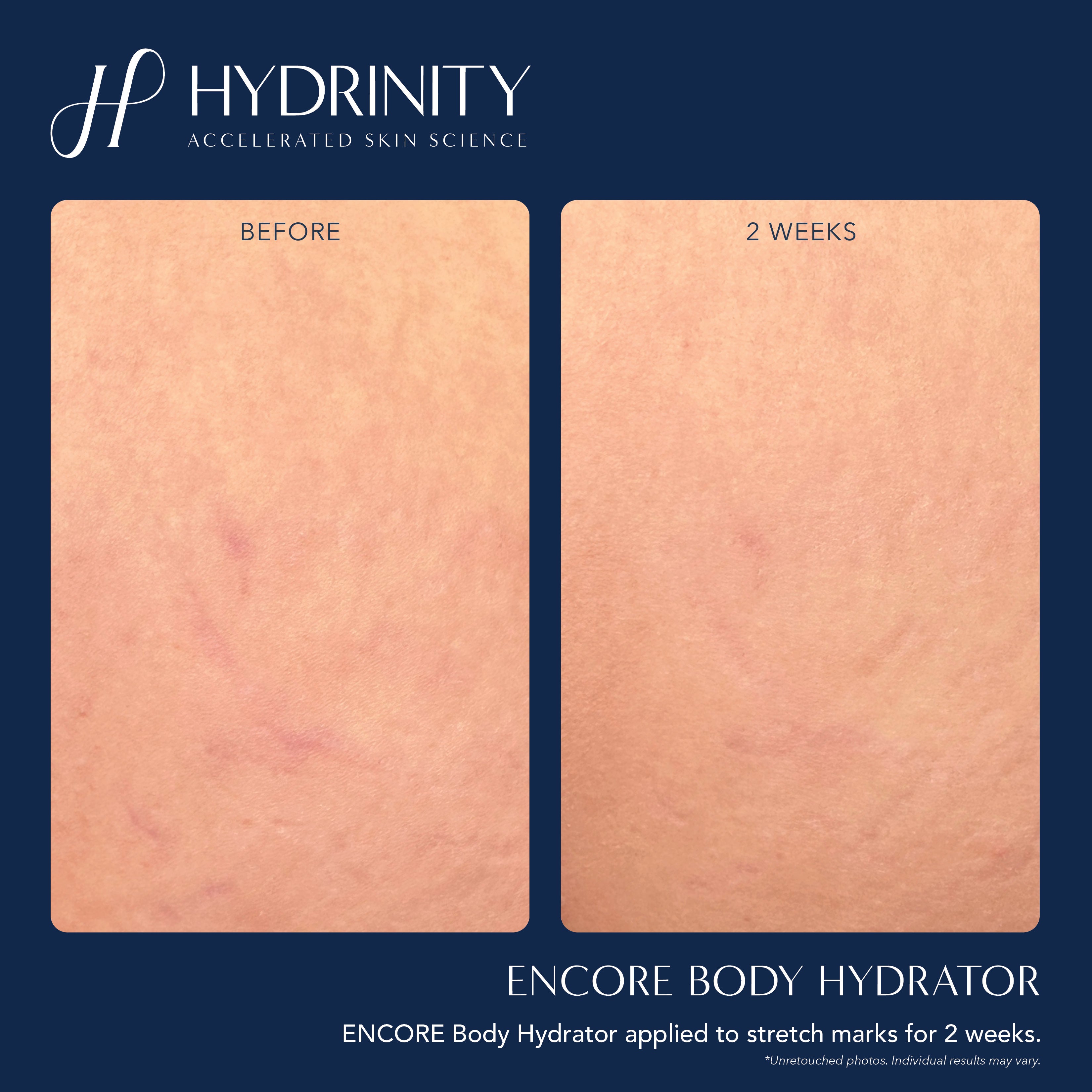 Hydrinity ENCORE Body Hydrator (7 oz)