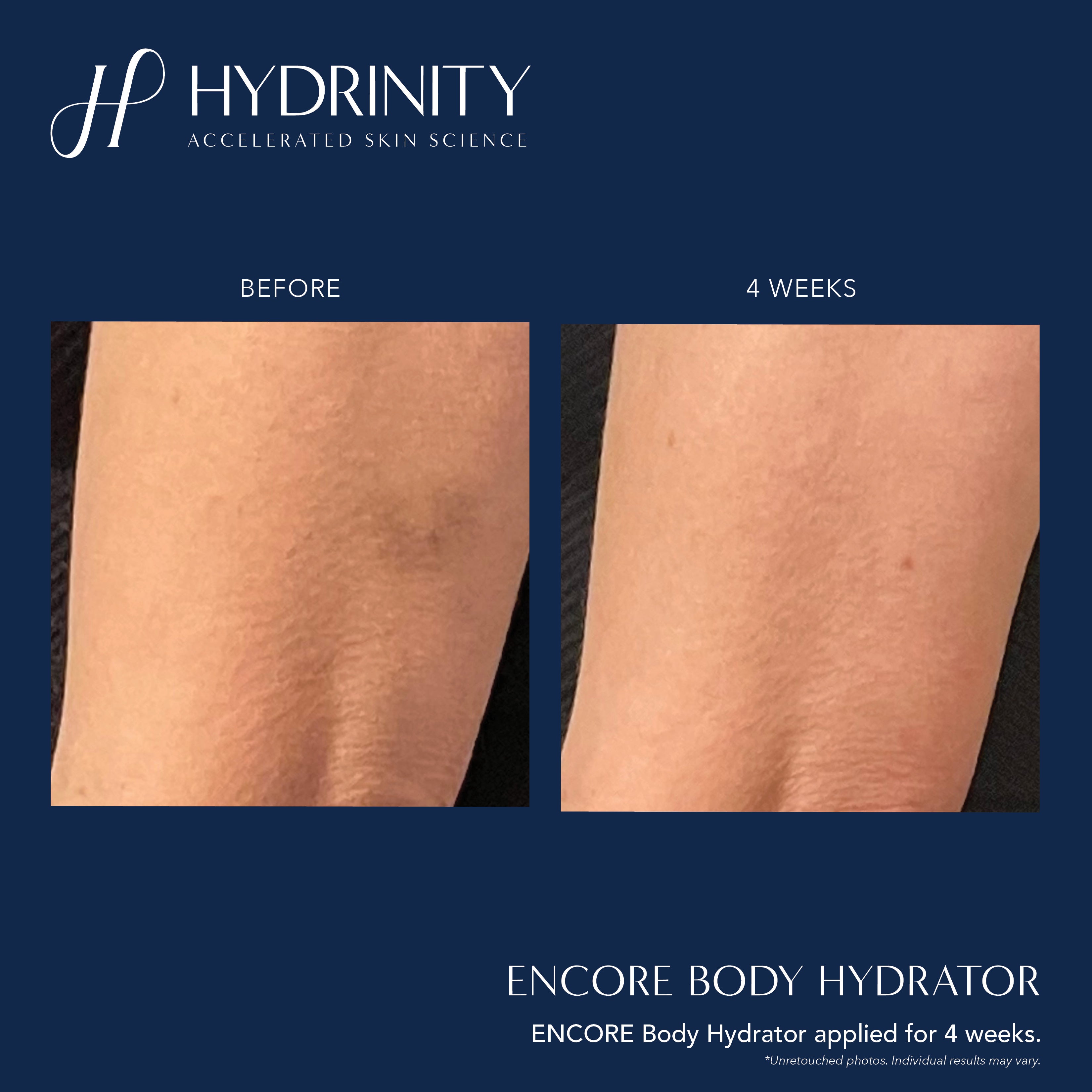 Hydrinity ENCORE Body Hydrator (7 oz)