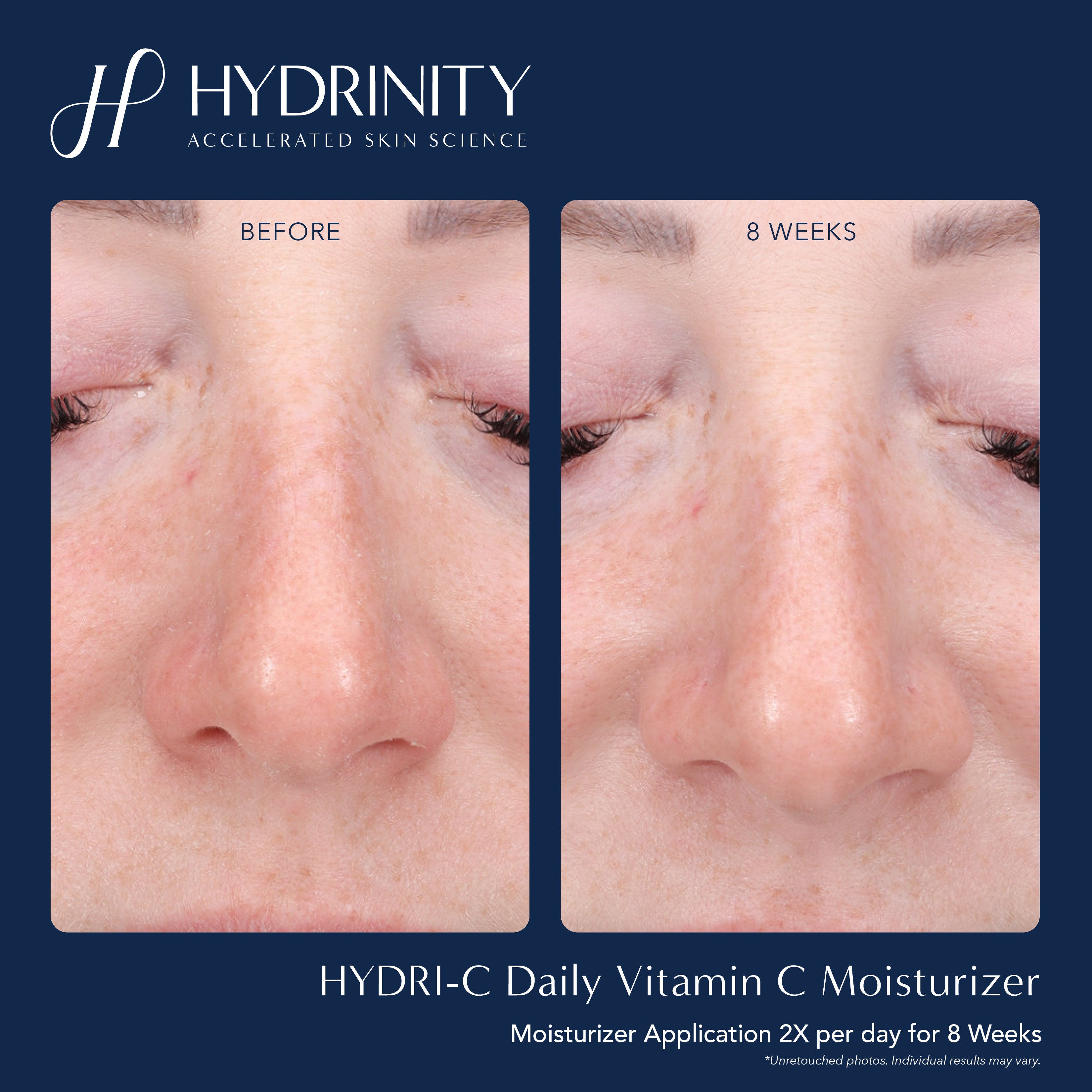 Hydrinity HYDRI-C Daily Vitamin C Moisturizer (1.7 oz)