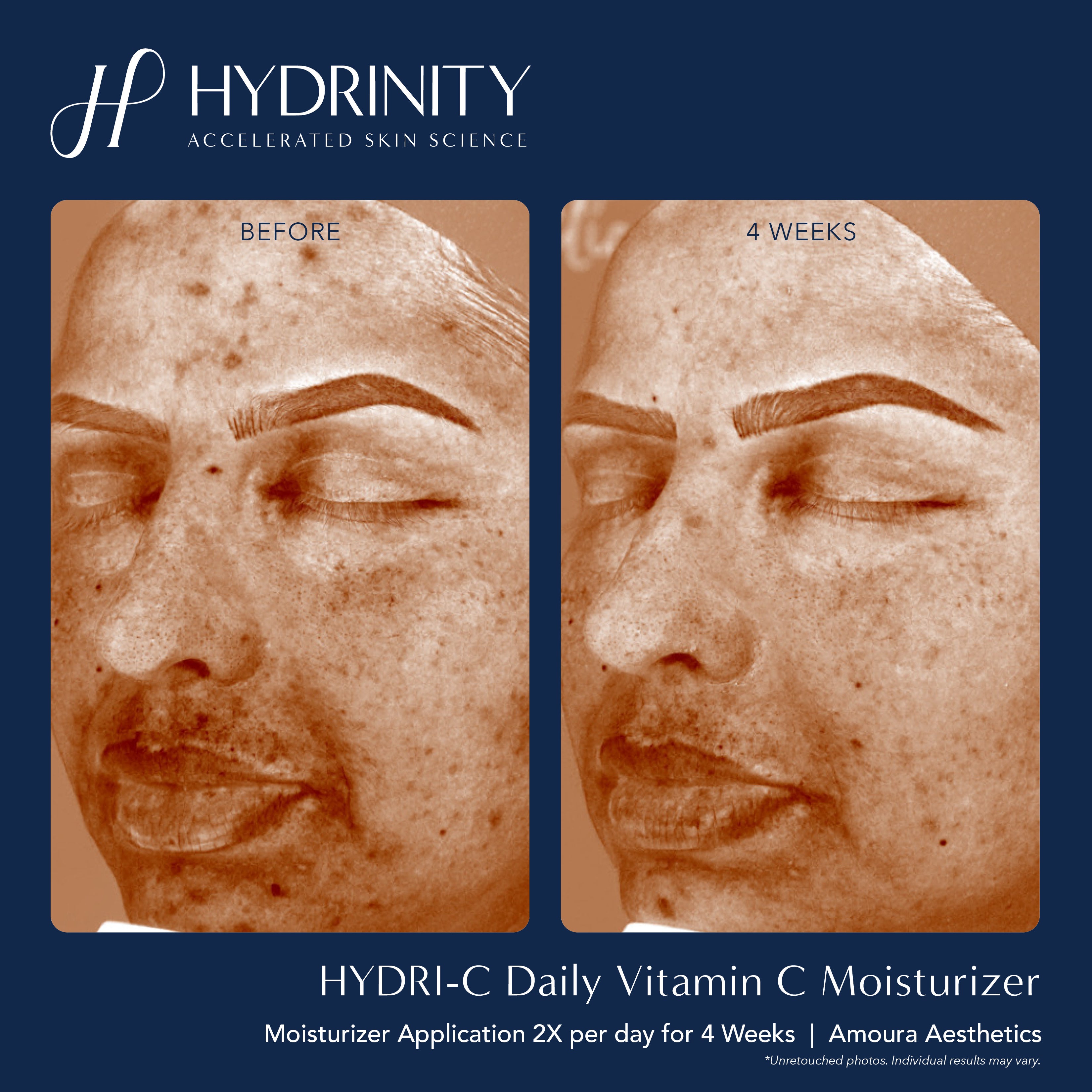 Hydrinity HYDRI-C Daily Vitamin C Moisturizer (1.7 oz)