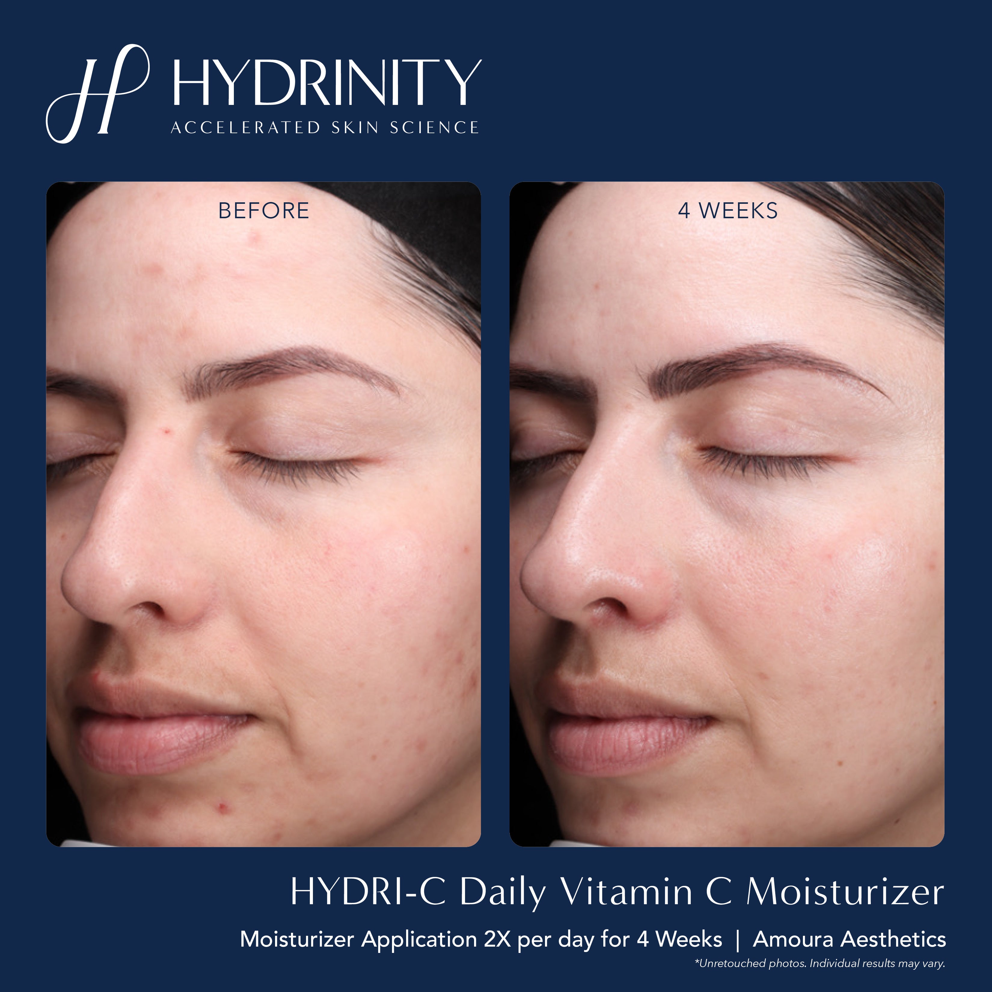Hydrinity HYDRI-C Daily Vitamin C Moisturizer (1.7 oz)