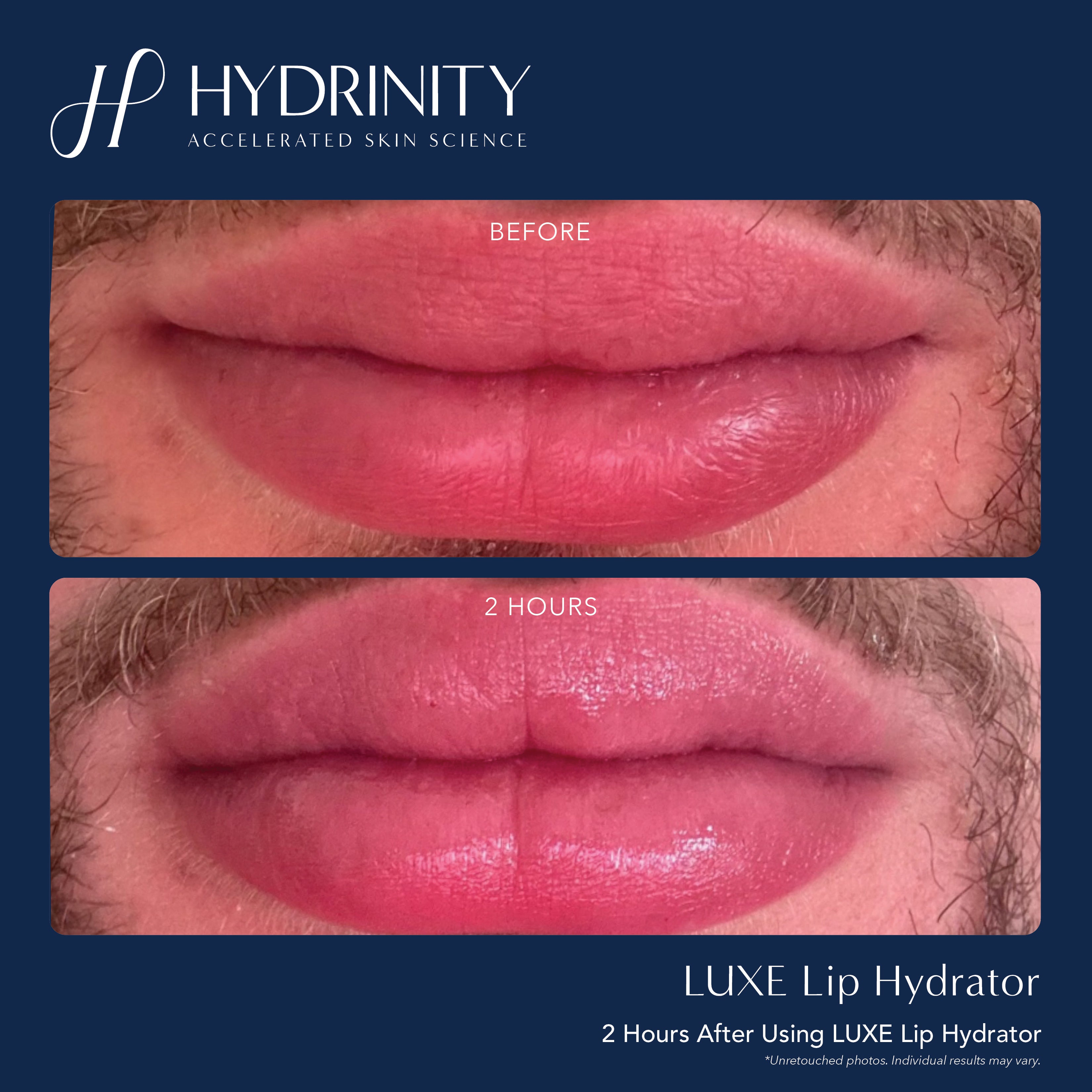 Hydrinity LUXE Lip Hydrator (0.34 oz)