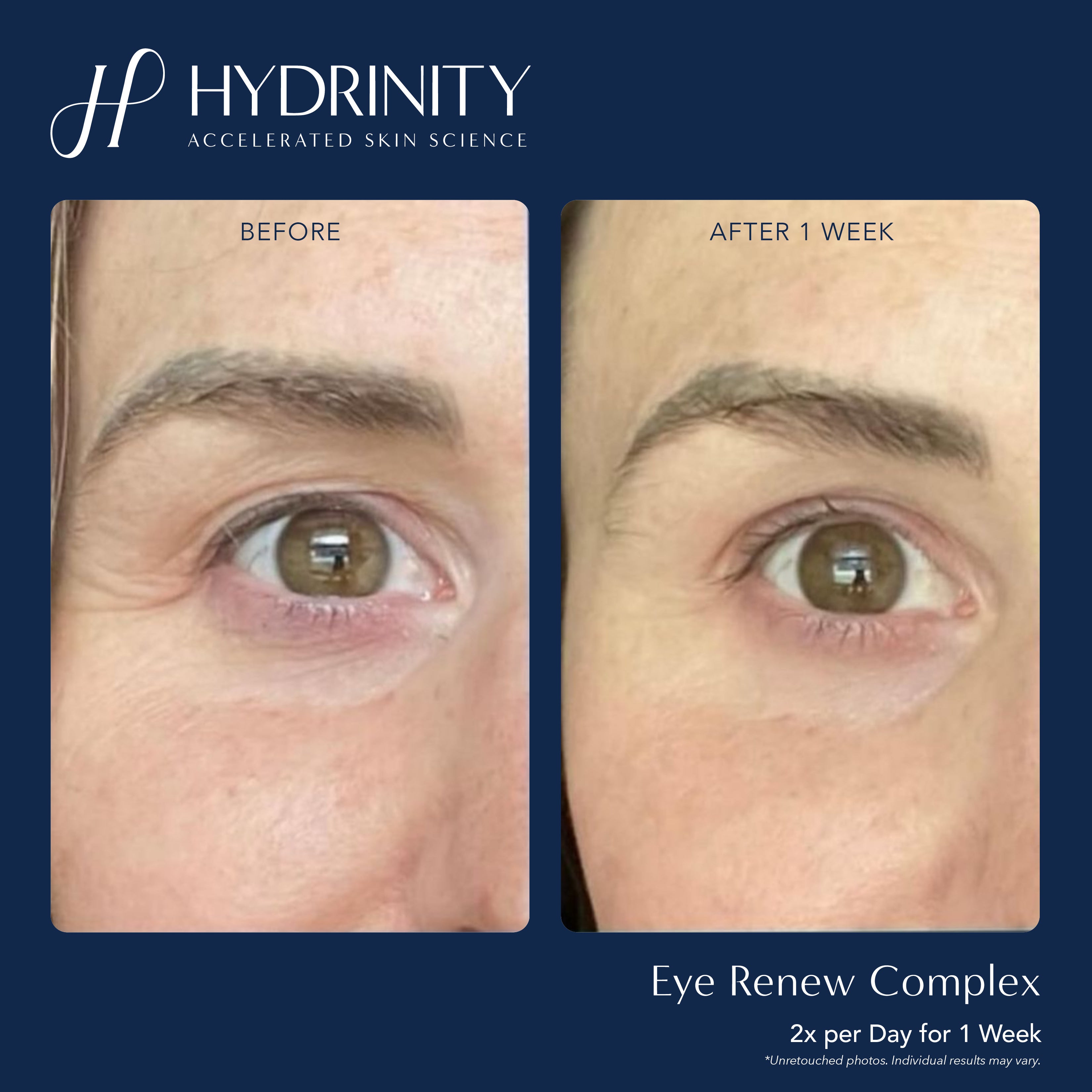 Hydrinity Eye Renew Complex (0.5 oz)