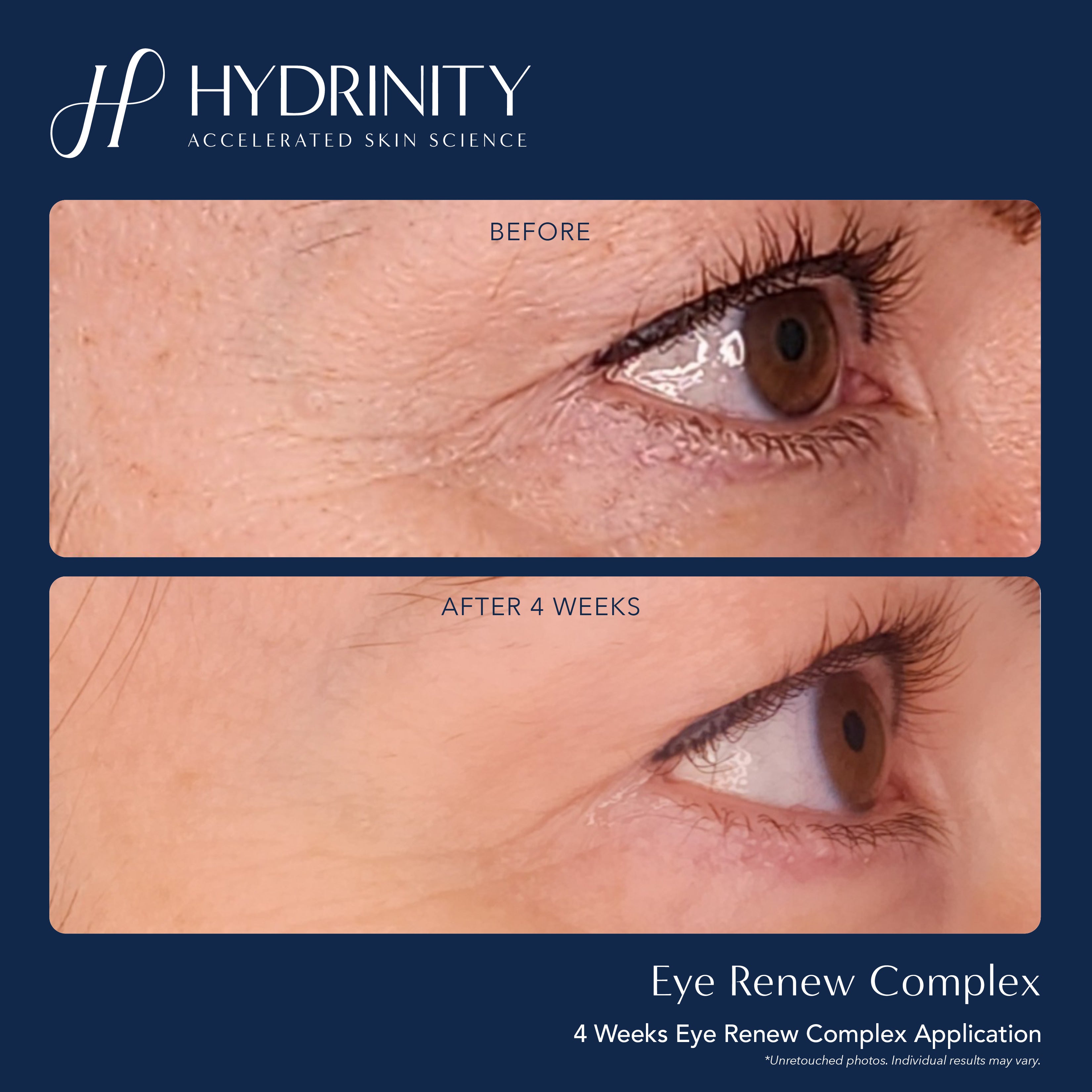 Hydrinity Eye Renew Complex (0.5 oz)
