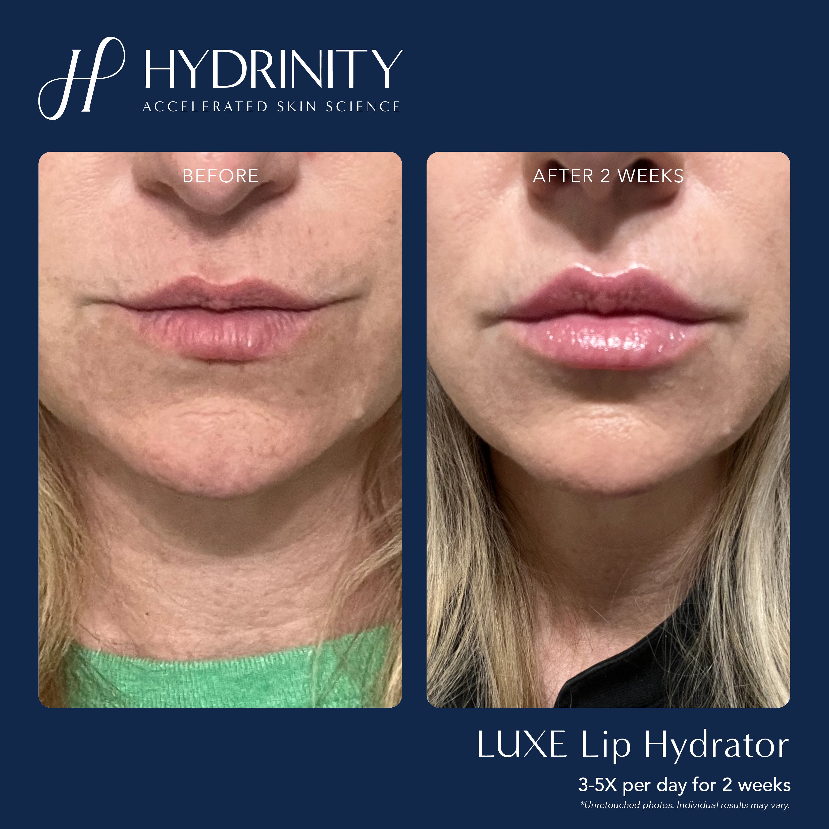 Hydrinity LUXE Lip Hydrator (0.34 oz)