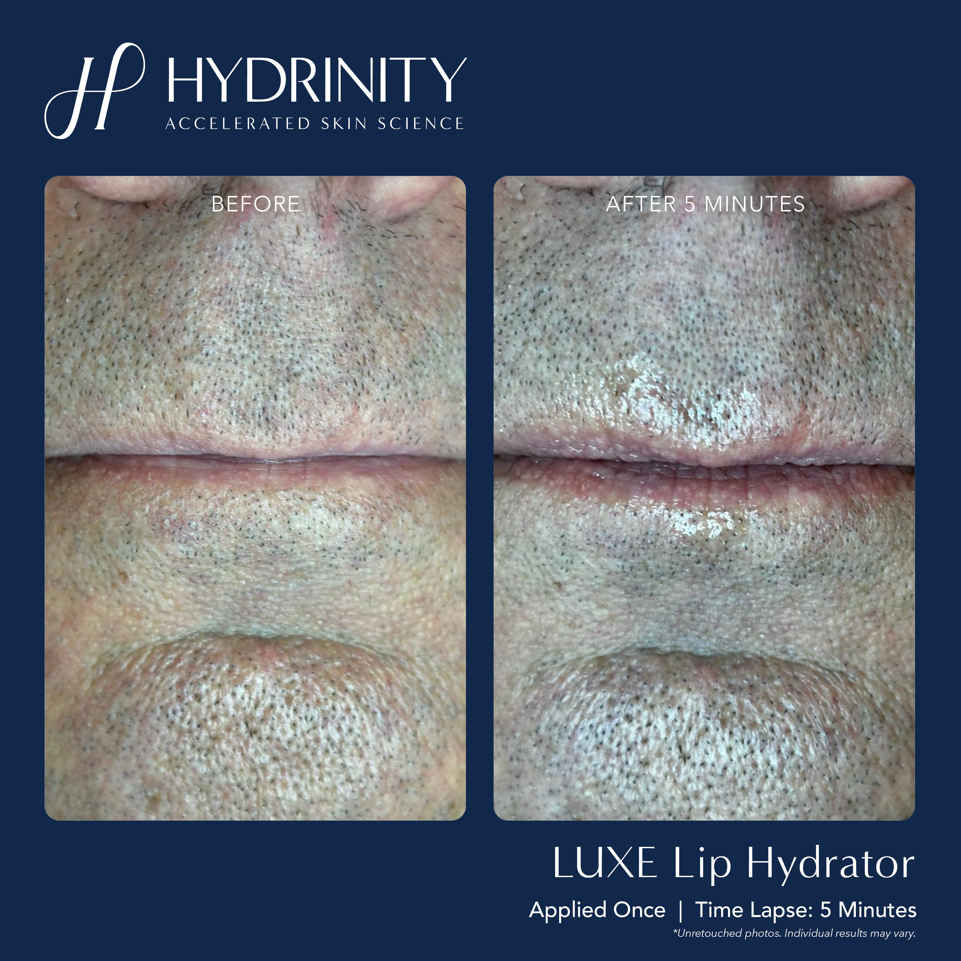 Hydrinity LUXE Lip Hydrator (0.34 oz)