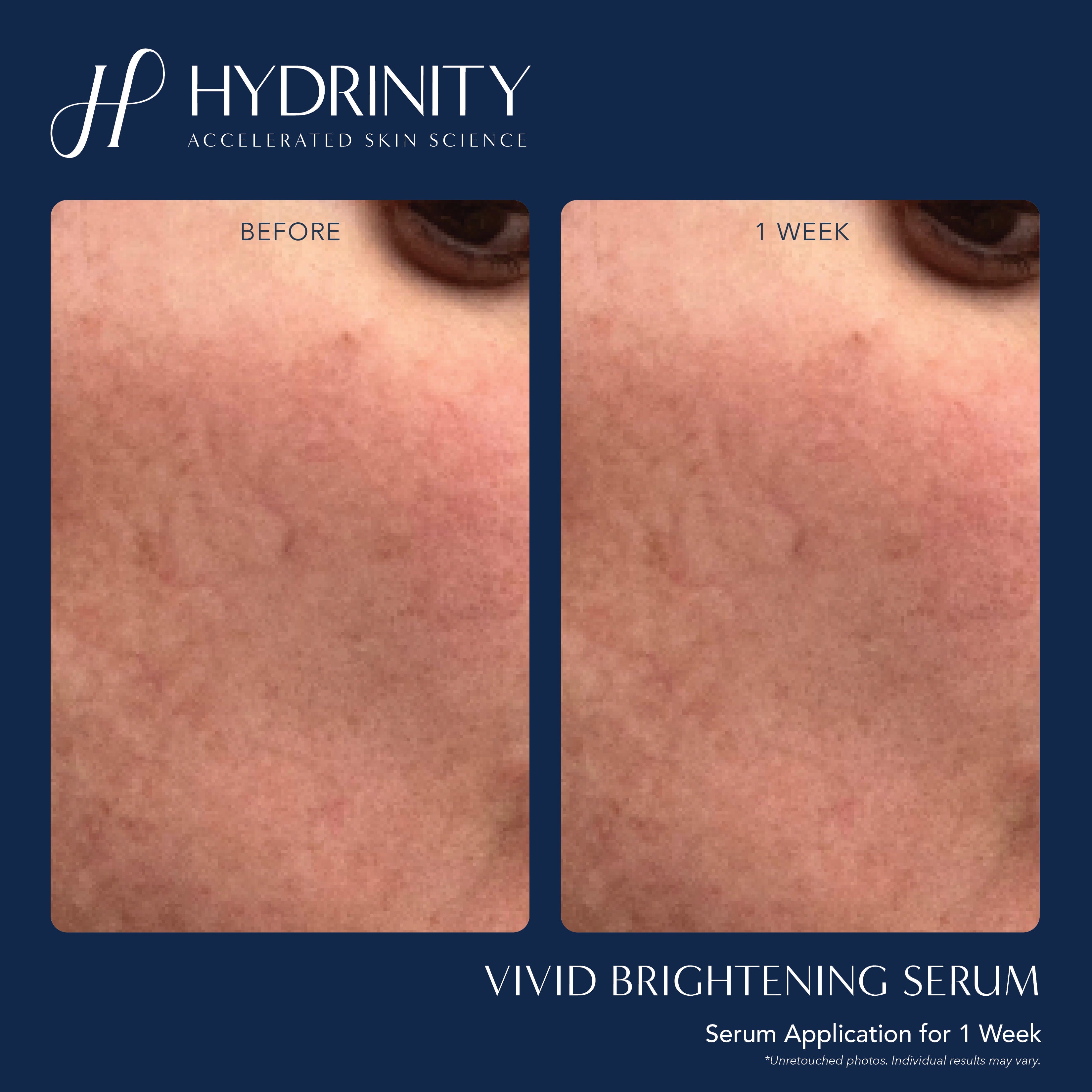 Hydrinity VIVID Brightening Serum (1 oz)