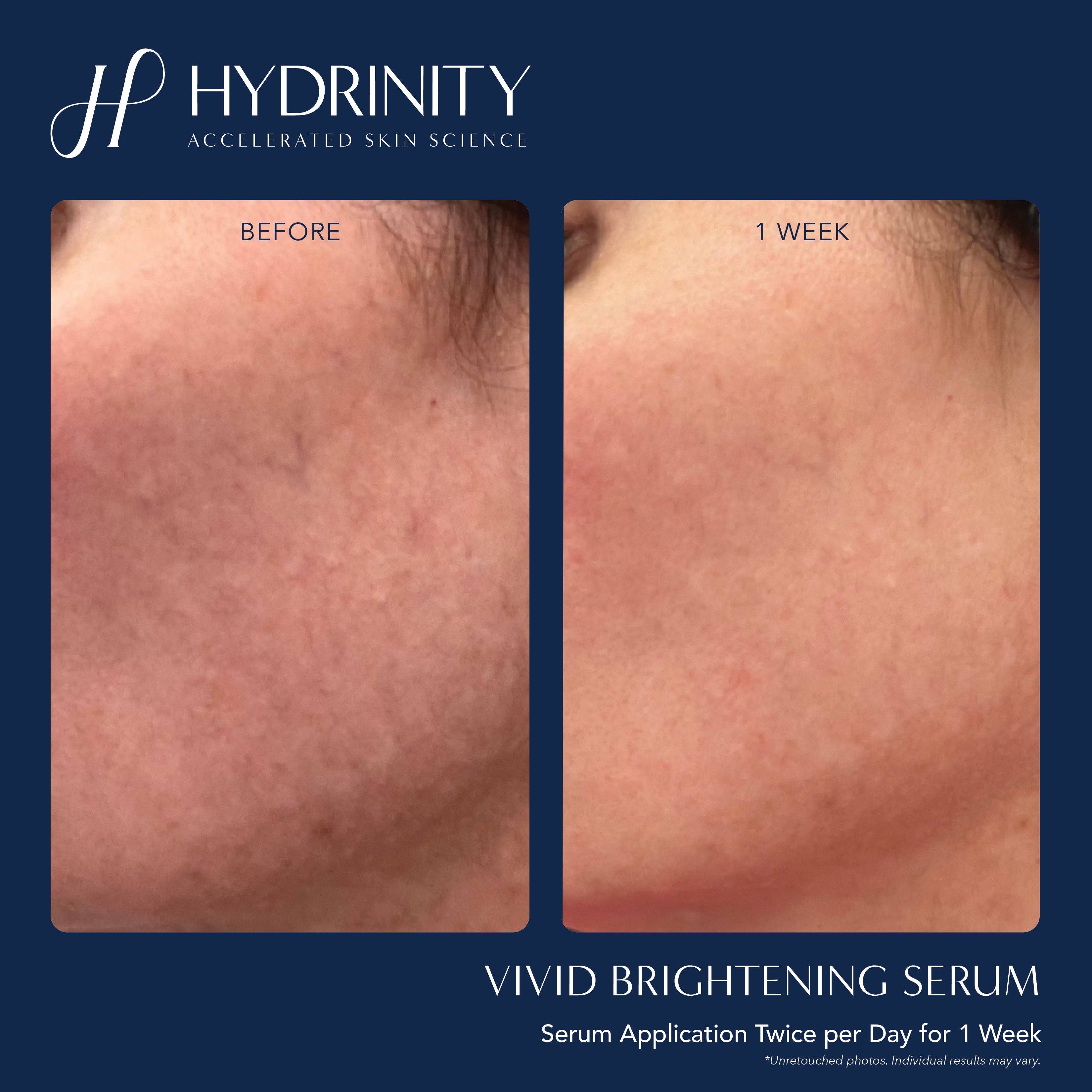Hydrinity VIVID Brightening Serum (1 oz)