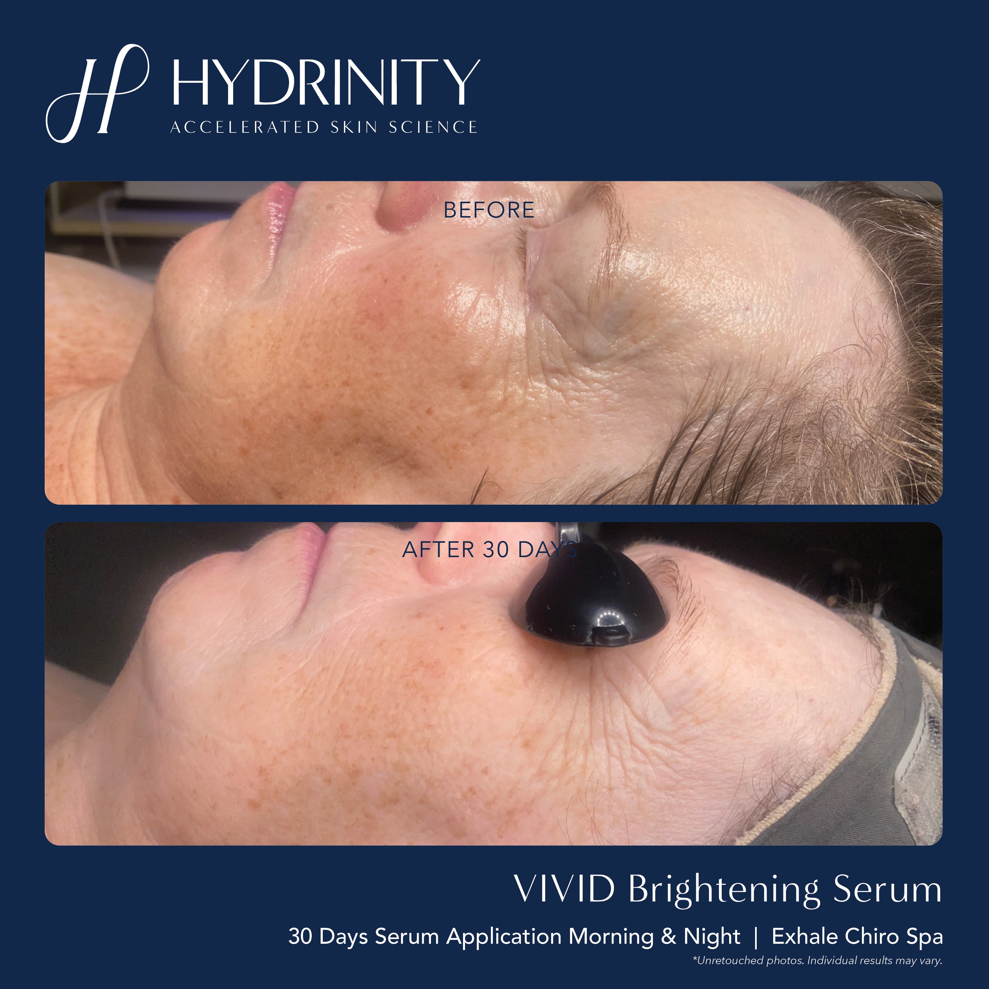 Hydrinity VIVID Brightening Serum (1 oz)