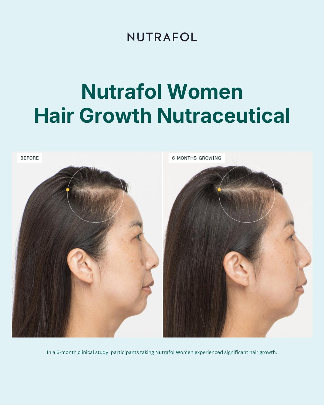 Nutrafol Women Advanced Formula Hair Growth Nutraceutical (120 Capsules)