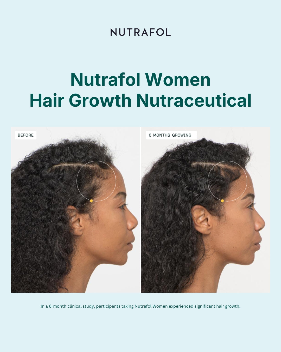 Nutrafol Women Advanced Formula Hair Growth Pack
