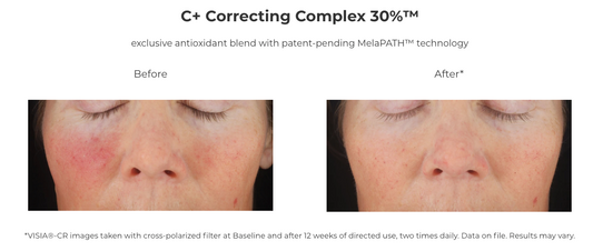 Revision Skincare C+ Correcting Complex 30%® Travel Size (0.5 oz).