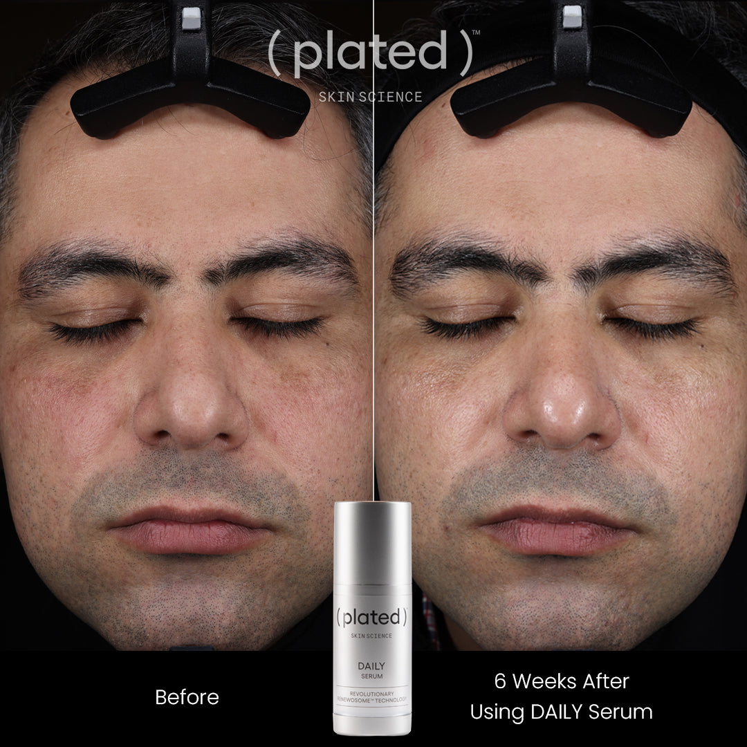 Plated Skin Science Daily Serum bottle showcasing premium skincare formulation for daily skin nourishment
