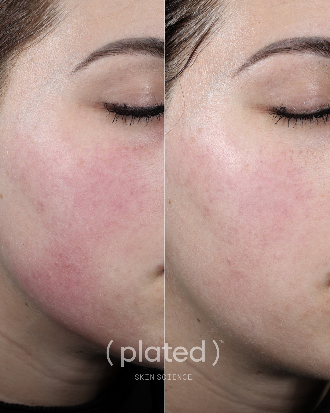 Plated Skin Science Daily Serum bottle showcasing premium skincare formulation for daily skin nourishment