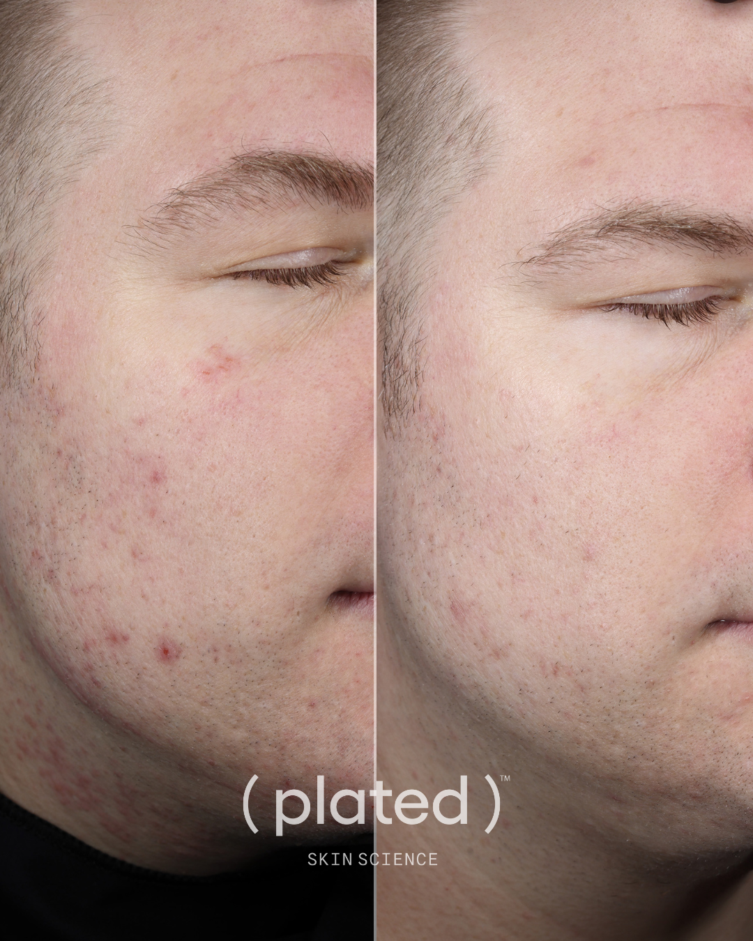 Plated Skin Science Daily Serum bottle showcasing premium skincare formulation for daily skin nourishment