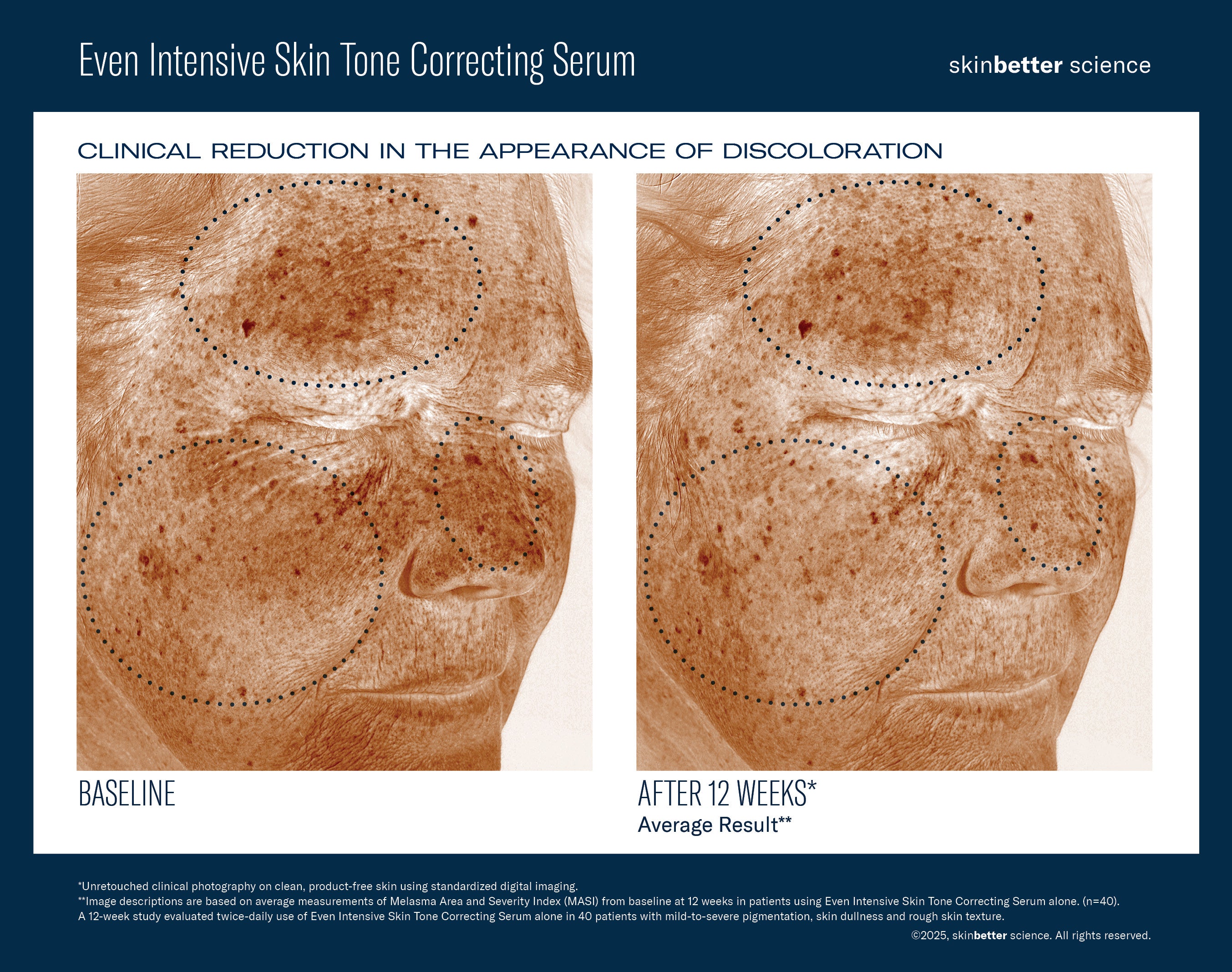 SkinBetter Science Even Intensive Skin Tone Correcting Serum (1.7 oz).