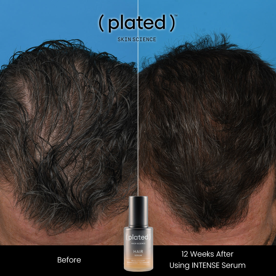 Plated Skin Science Hair Serum bottle with natural ingredients promoting hair growth and shine