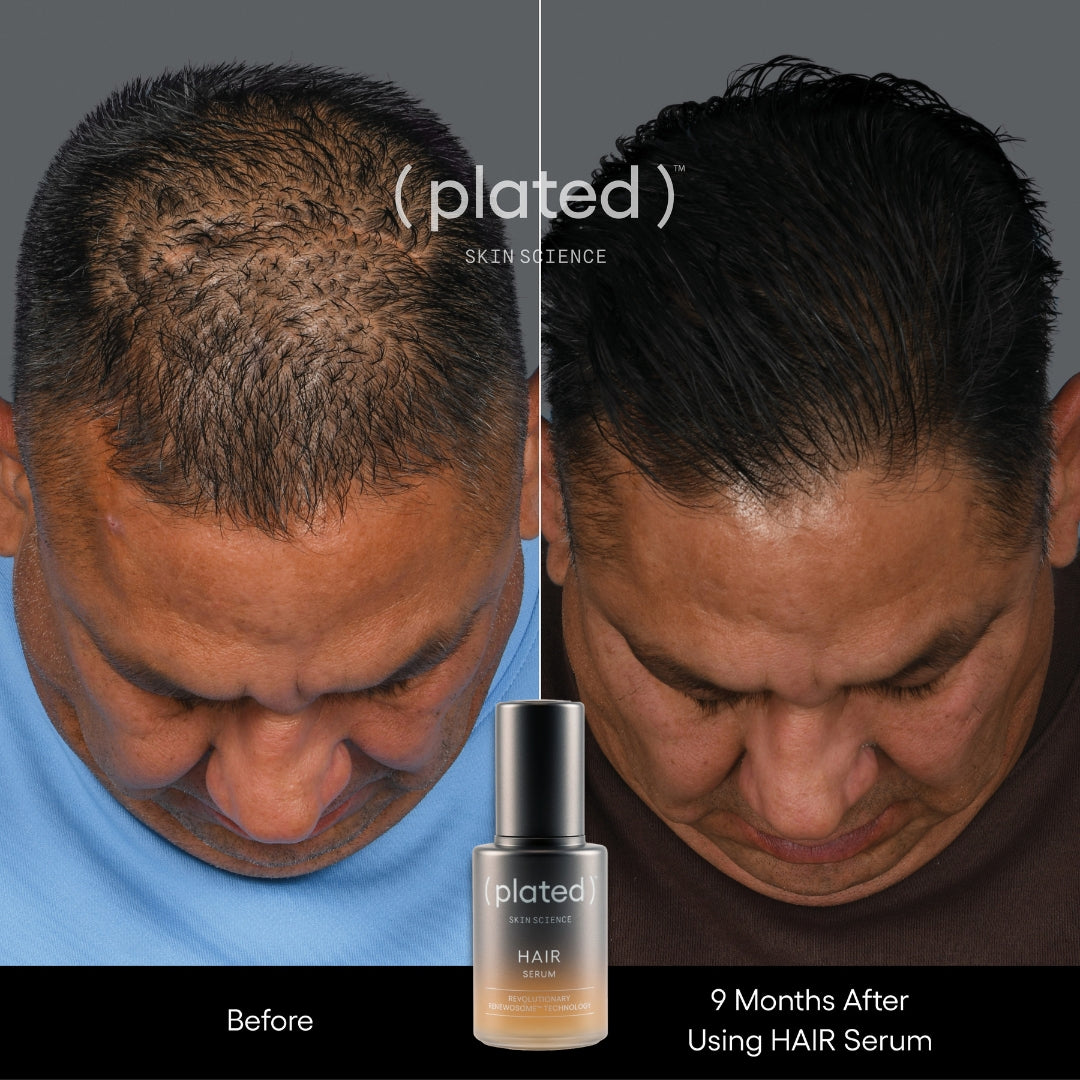 Plated Skin Science Hair Serum bottle with natural ingredients promoting hair growth and shine