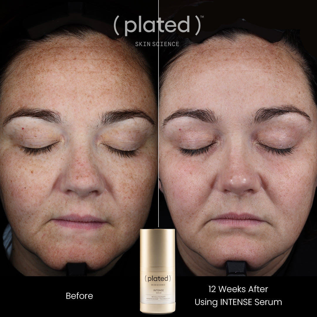 Plated Skin Science Intense Serum bottle with natural ingredients background for skincare and anti-aging